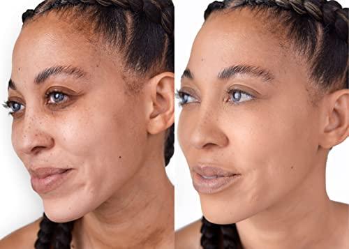 THE GOOD MINERAL The Good Mineral Loves-You-Back 3in1 Mineral Powder Foundation (CARAMEL 1) | Designed for acne-prone, sensitive skin reducing the appearance of acne and scars without layers | Vegan + Cruelty Free