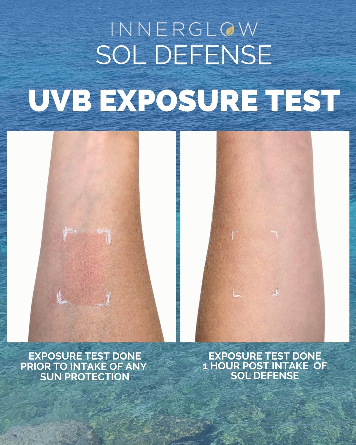 Inner Glow Inner Glow Sol Defense Gummies - Dermatologist and Plastic Surgeon developed to fight photoaging, Polypodium Leucotomos and Niacinamide