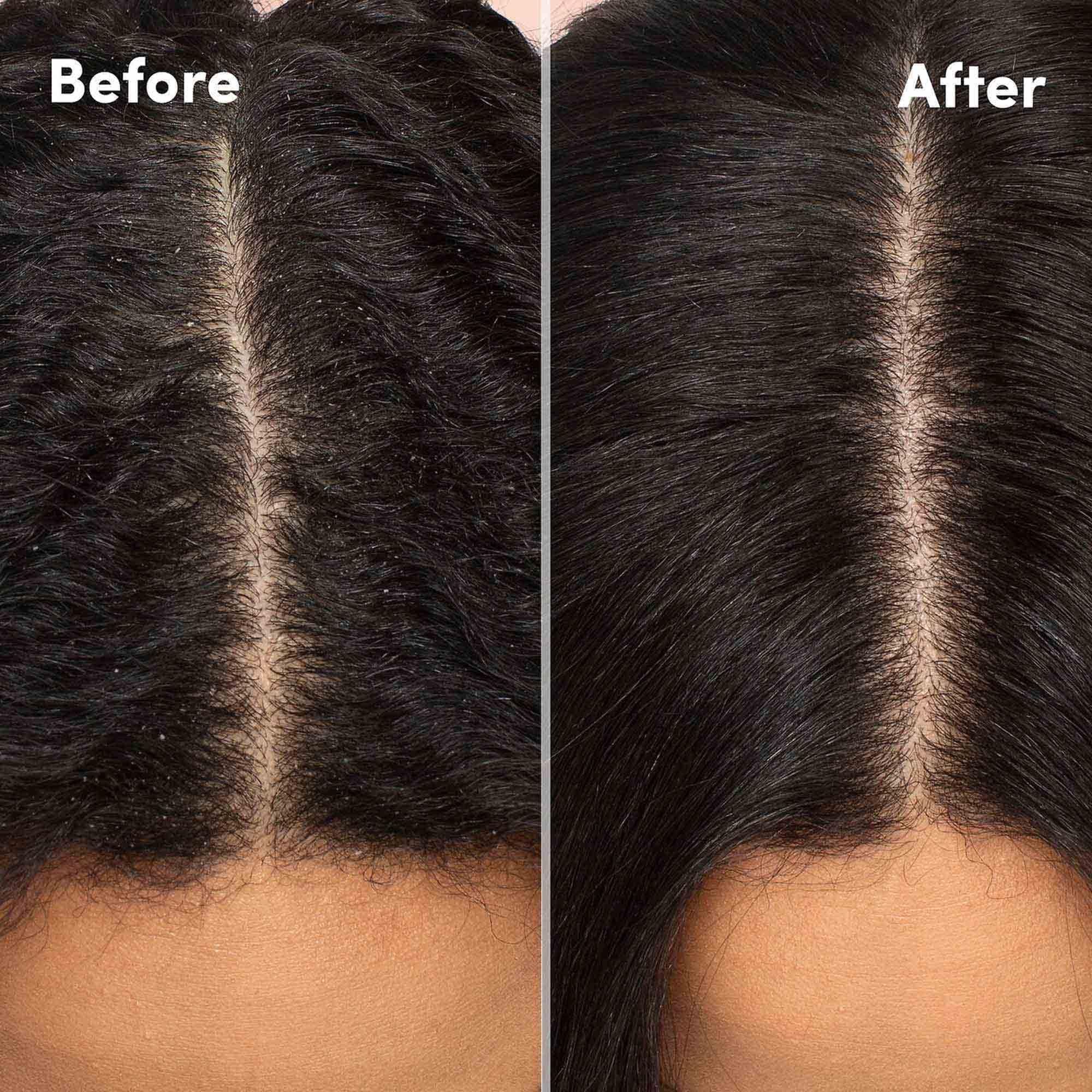 MIZANI MIZANI Scalp Care Dandruff Shampoo | Pyrithione Zinc | Cleanses Hair & Scalp | For Curly Hair | 16.9 Fl Oz