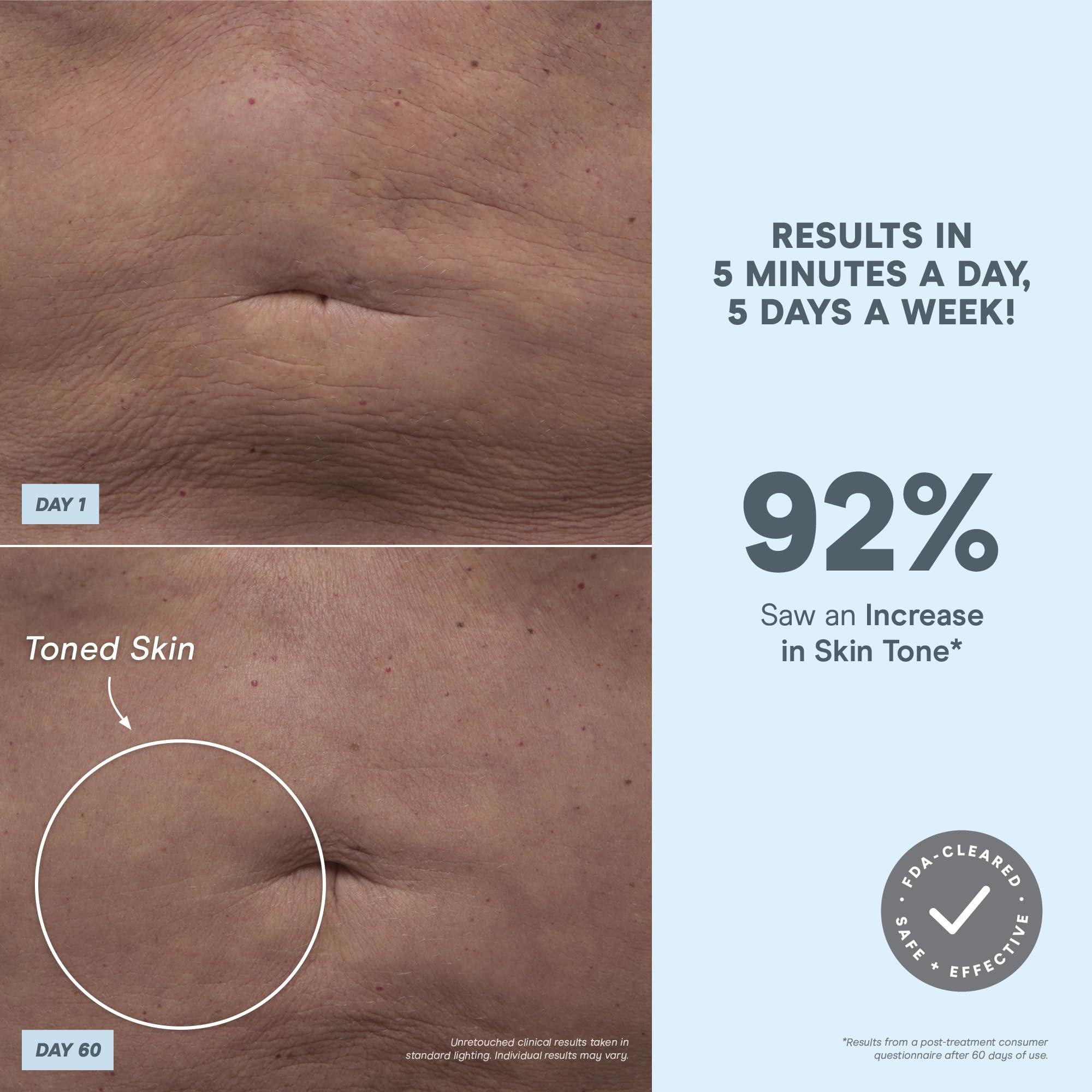 NuFACE NuFACE NuBODY Toning Device - FDA Cleared Microcurrent Device for All-Over Contouring, Firming & Skin Tightening