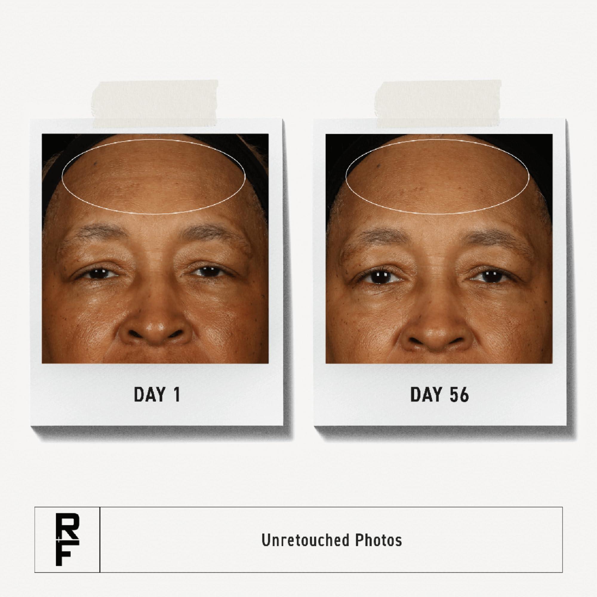 AMINZER Redefine Triple Defense Treatment,30mL/1Fl. Oz