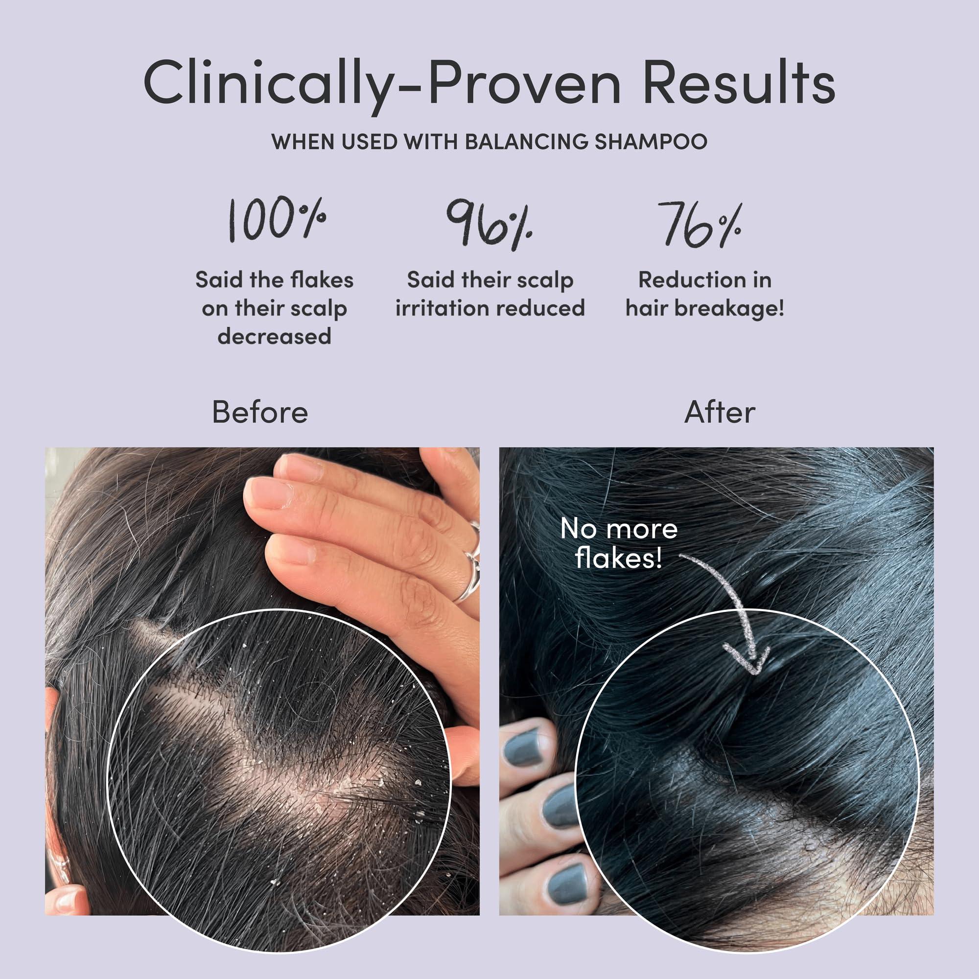 Jupiter Jupiter Anti-Dandruff Shampoo and Serum, for Women & Men, Dermatologist-Formulated for Flaky, Itchy, Oily, & Dry Scalp, Sulfate-Free, Vegan, Color-Safe, & Paraben-Free, Shampoo with Zinc