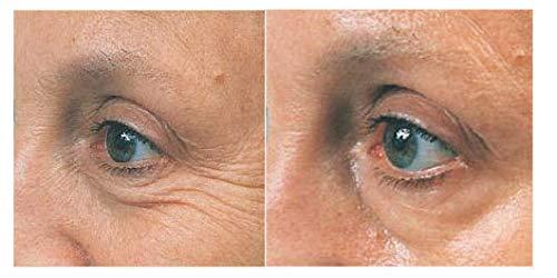 Bellahut Skin Care DER-MAX-YL (Palmitoyl Hexapeptide-12) - Mix in with your favorite cream, gel, lotion or serum to make your own skin care solution. FOR THE REDUCTION OF DEEP WRINKLES, CROWS FEET AND UNDER THE EYES (10 ml)