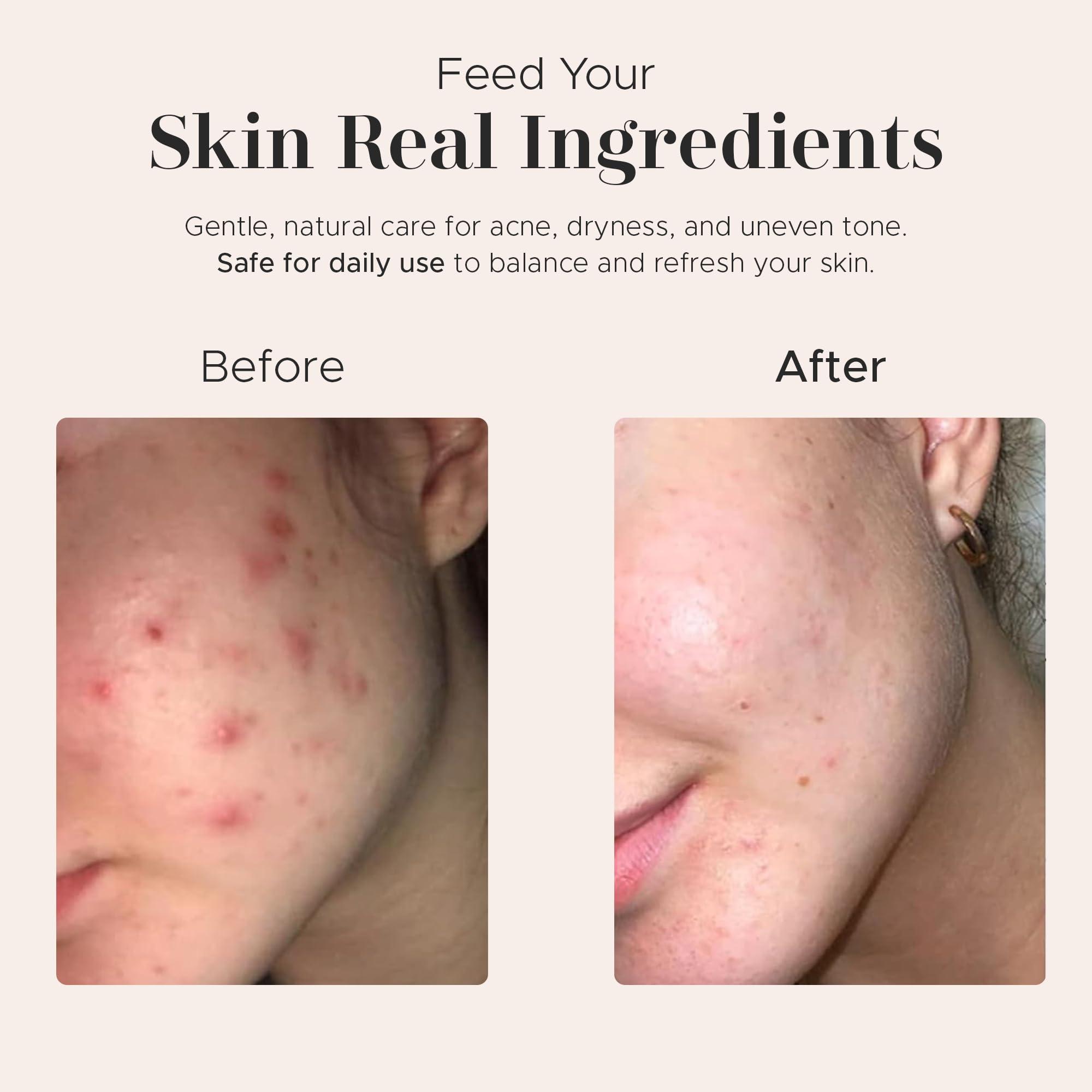 era of nature era of nature Best Raw ORGANIC AFRICAN BLACK SOAP, for Dry Skin and Skin Conditions. Pure & Natural Ingredients, Imported From Ghana - 1lb (16oz)