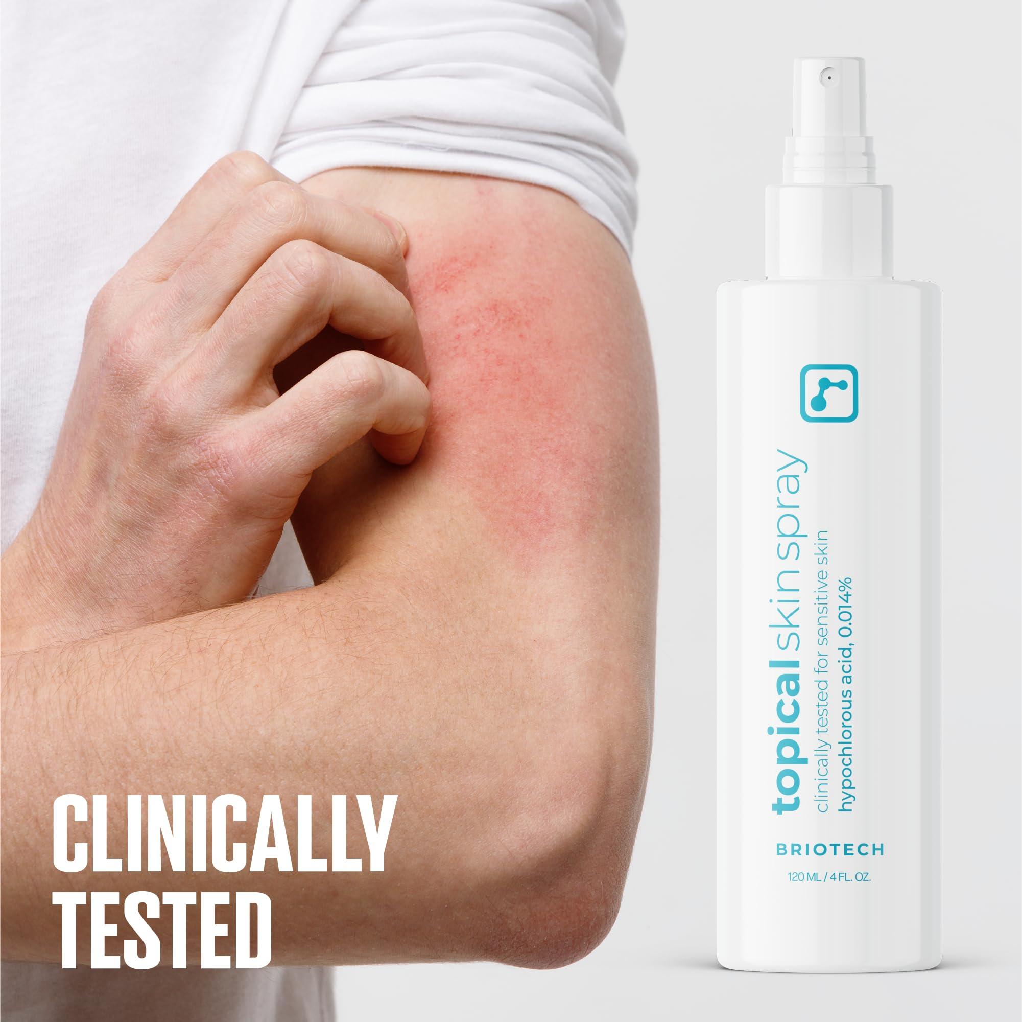 BRIOTECH BRIOTECH Topical Skin Spray, Hypochlorous Acid Spray for Body & Face, Eyelid Cleanser, HOCl Facial Mist, Support Against Irritation, Calm Redness, Soothe Scalp, Packaging May Vary, 4 oz ea, 2 ct