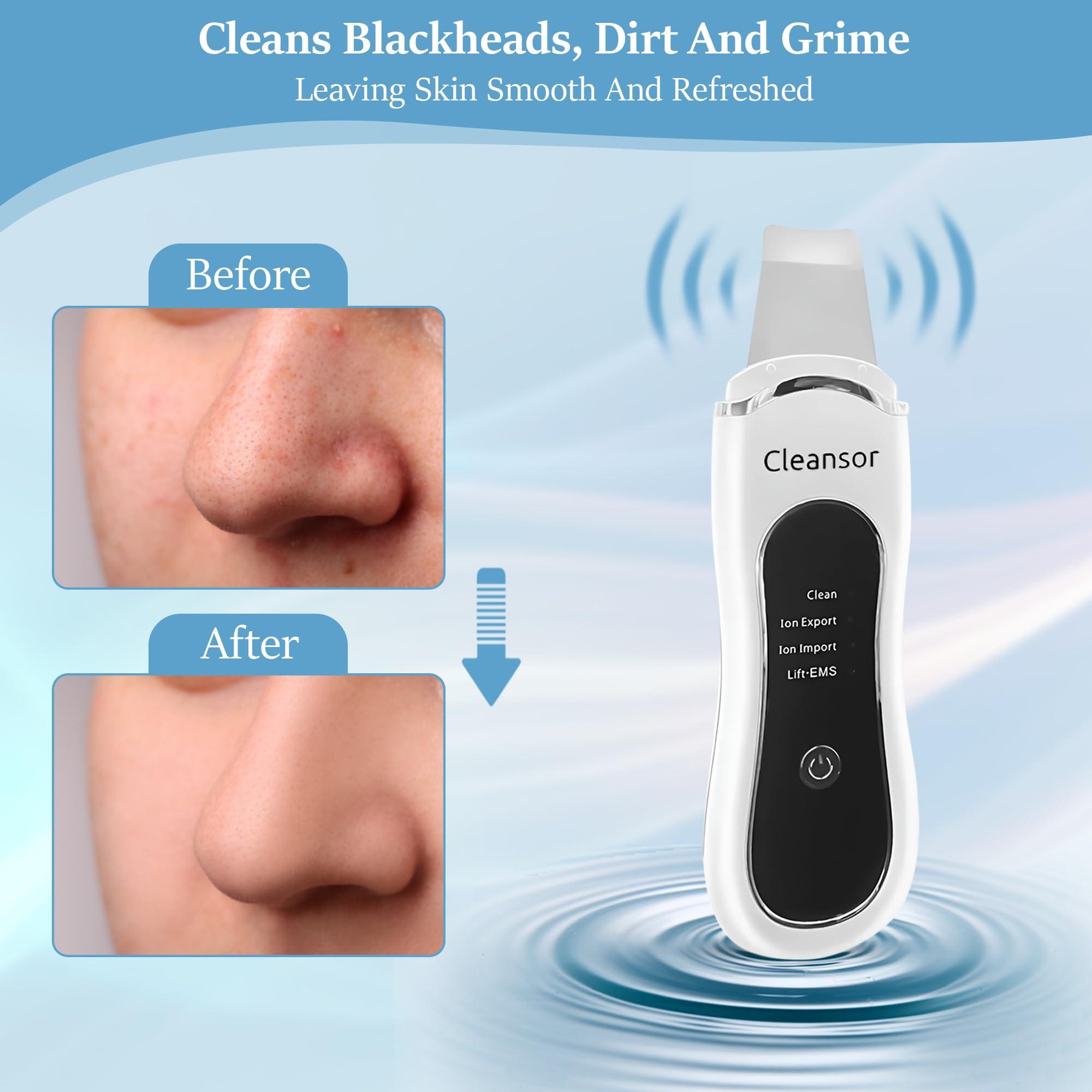 Cleansor Skin Scrubber Pore Cleaner Blackhead Remover Facial Spatula with Clean, Ion and Lift Modes