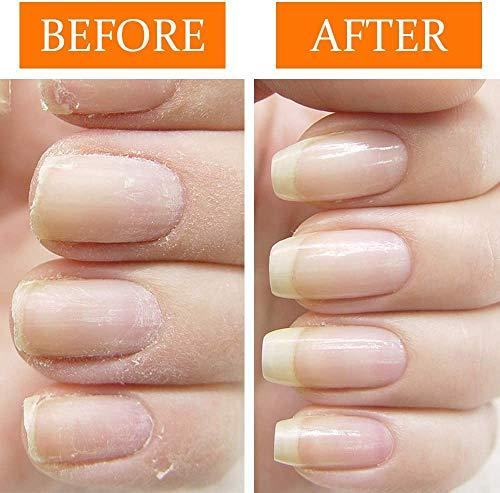 Nail Tek Nail Tek Repairs Damaged Nails kit.Intensive Therapy(.5OZ),Foundation(.5OZ)& Renew(.48OZ)