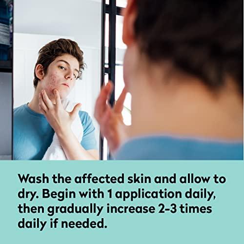 Dr. Blaine's All Acne Treatment - Face and Body - Spot and Full Coverage - Gel Formula - 9 Skin Boosters