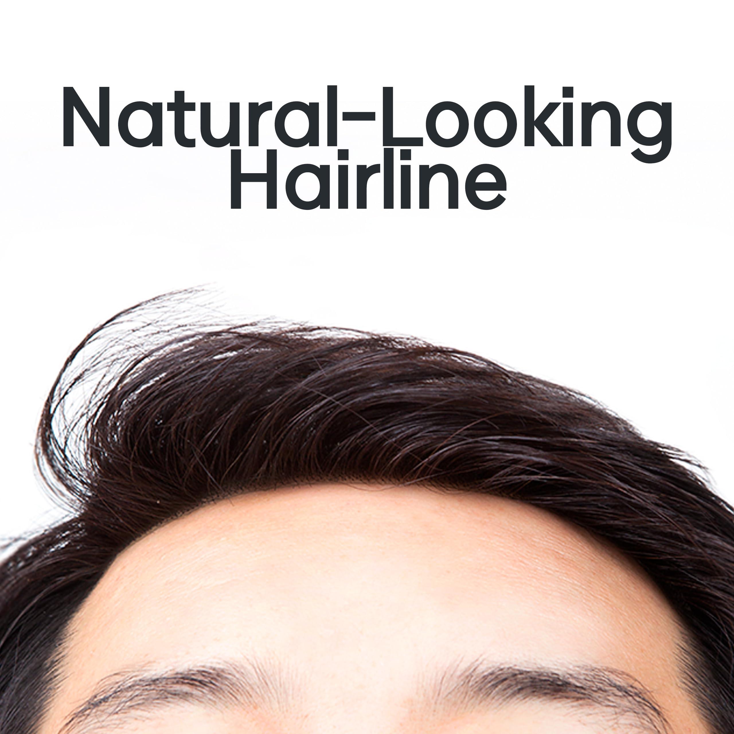 JY STORE Generic Men\'s 100% Human Hair Crown Partial Wig for Receding Hairline, M-Shaped Balding, and Alopecia Areata, Natural Black