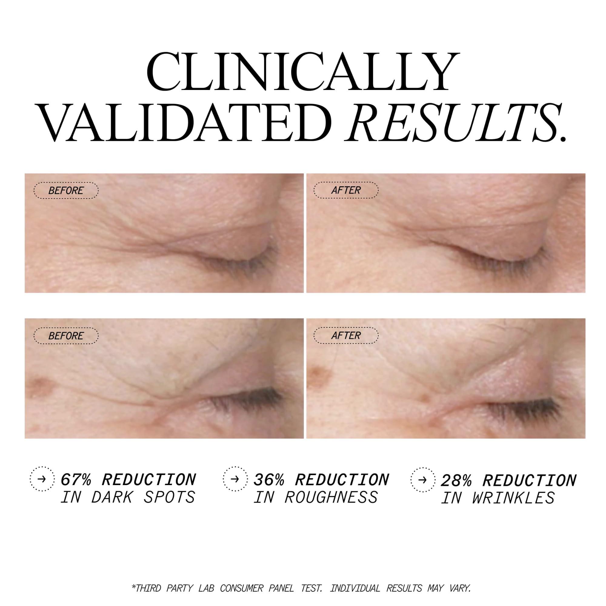 Juice Beauty Juice Beauty Stem Cellular Anti-Wrinkle Retinol Overnight Serum - 30 mL - Reduces Look of Fine Lines, Wrinkles, Dark Spots + Skin Roughness - Vegan, Cruelty Free