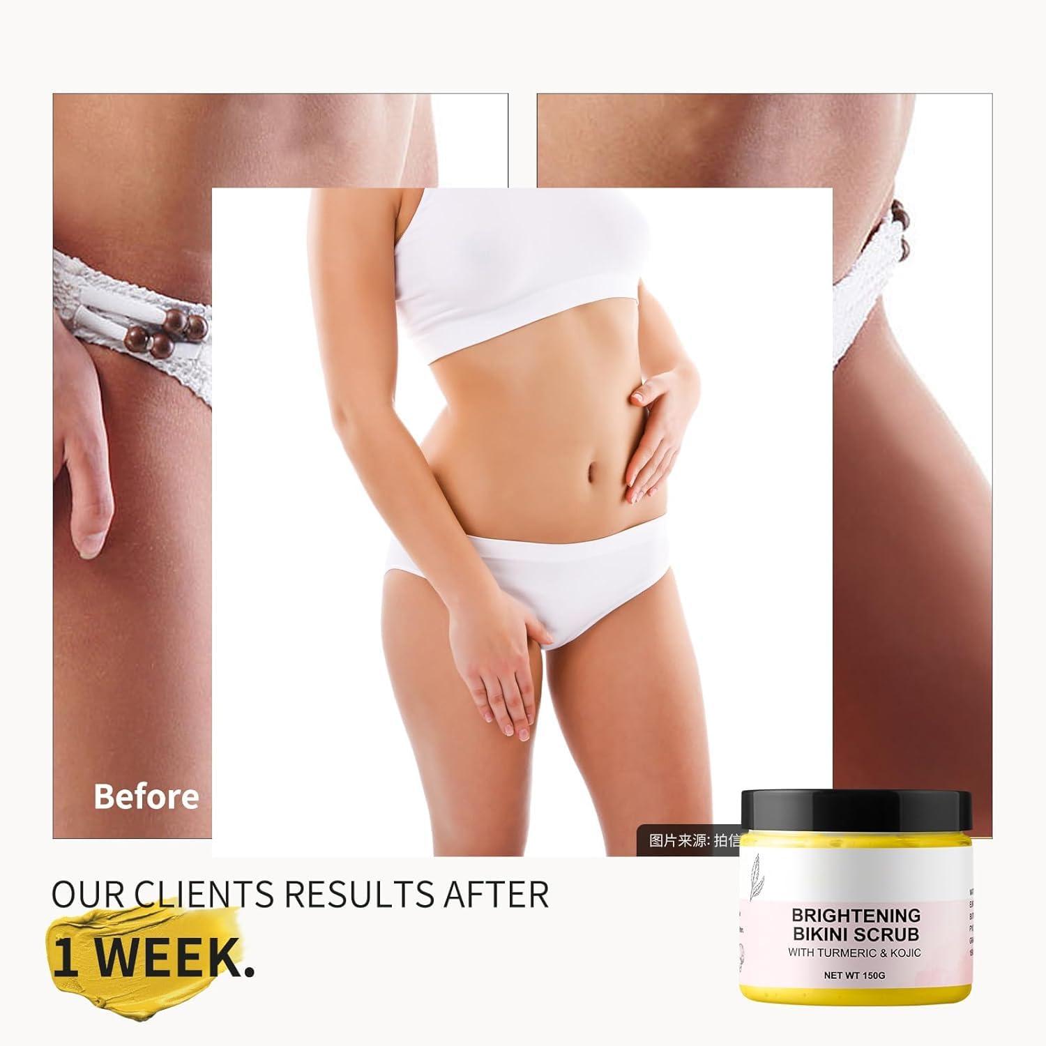 YAFUSIPE Bikini Area Exfoliator Exfoliating Body Scrub Turmeric Scrubs Kojic Bump Eraser KP Body Exfoliant Ingrown Hair Treatment Body Scrubs for Inner Thighs Bikini Line Intimate Area Armpit 5.29OZ