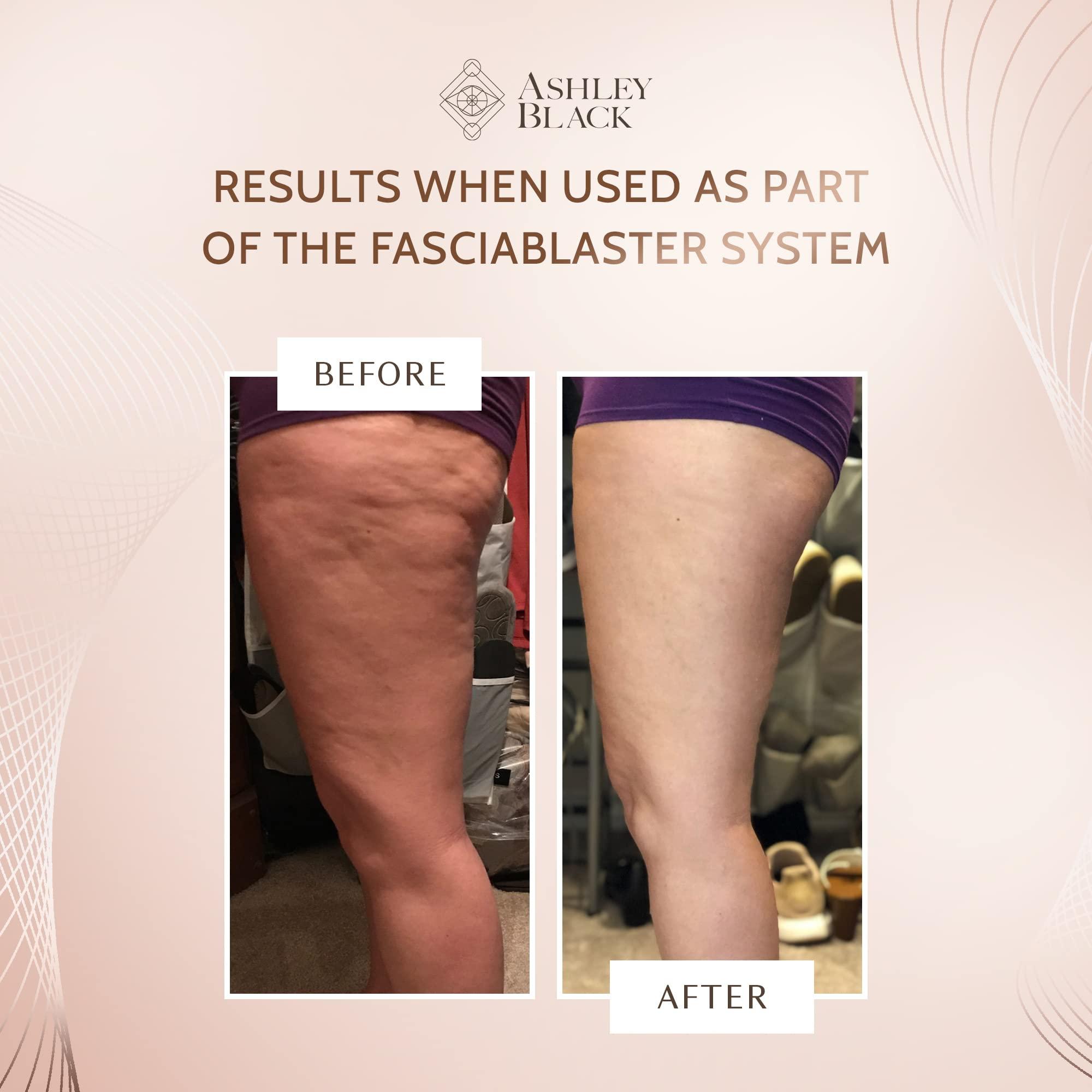 FasciaBlaster The Brush & Blast™ FasciaBlaster by Ashley Black - The Ultimate Skin and Fascia Tool