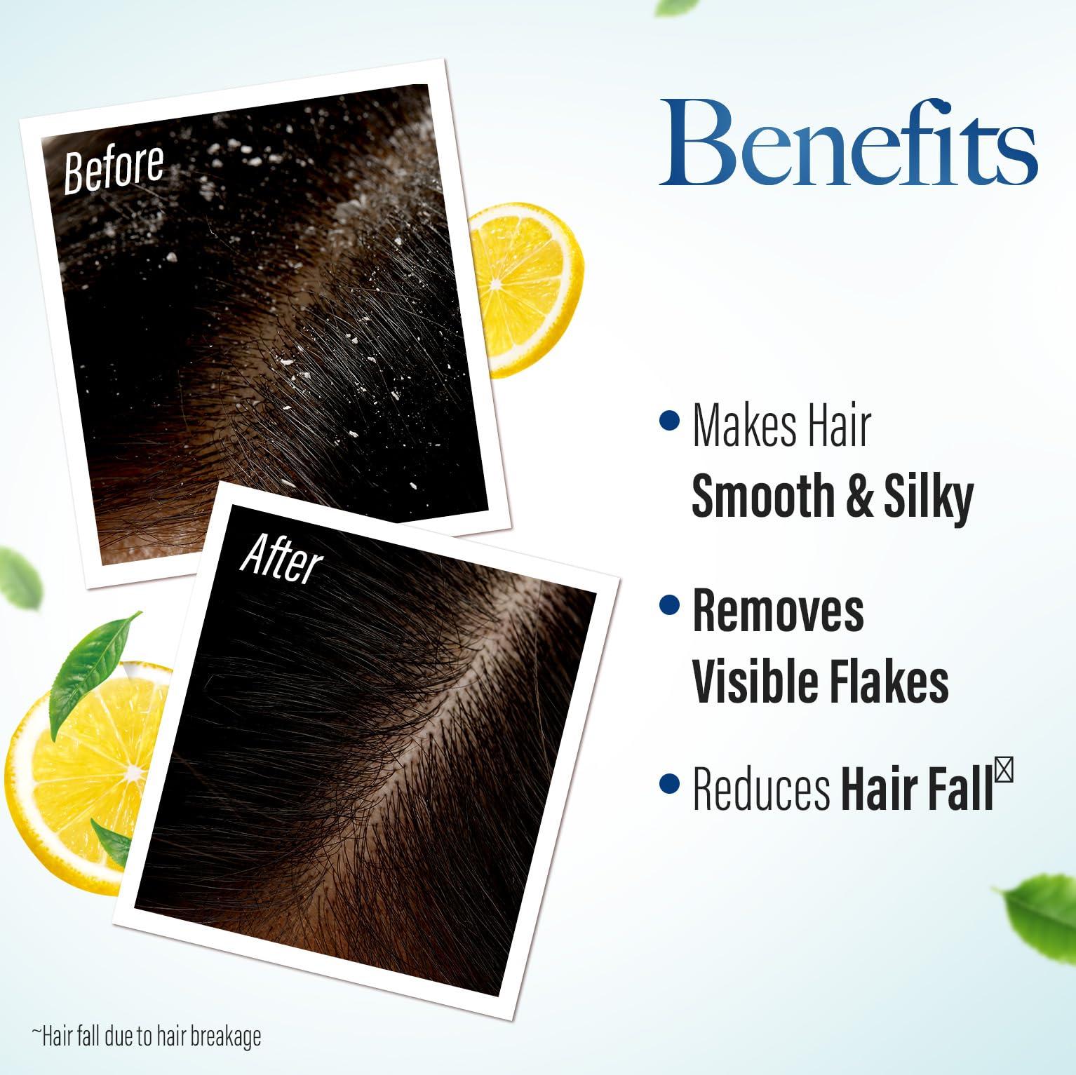 KESH KING KESH KING Anti Dandruff Shampoo | Ayurvedic Hair Cleanser with Curd & Lemon | Reduce Hairfall | Nourishes Itchy Scalp | Gives Smooth & Soft Hairs | 20.29 Fl Oz/600ml