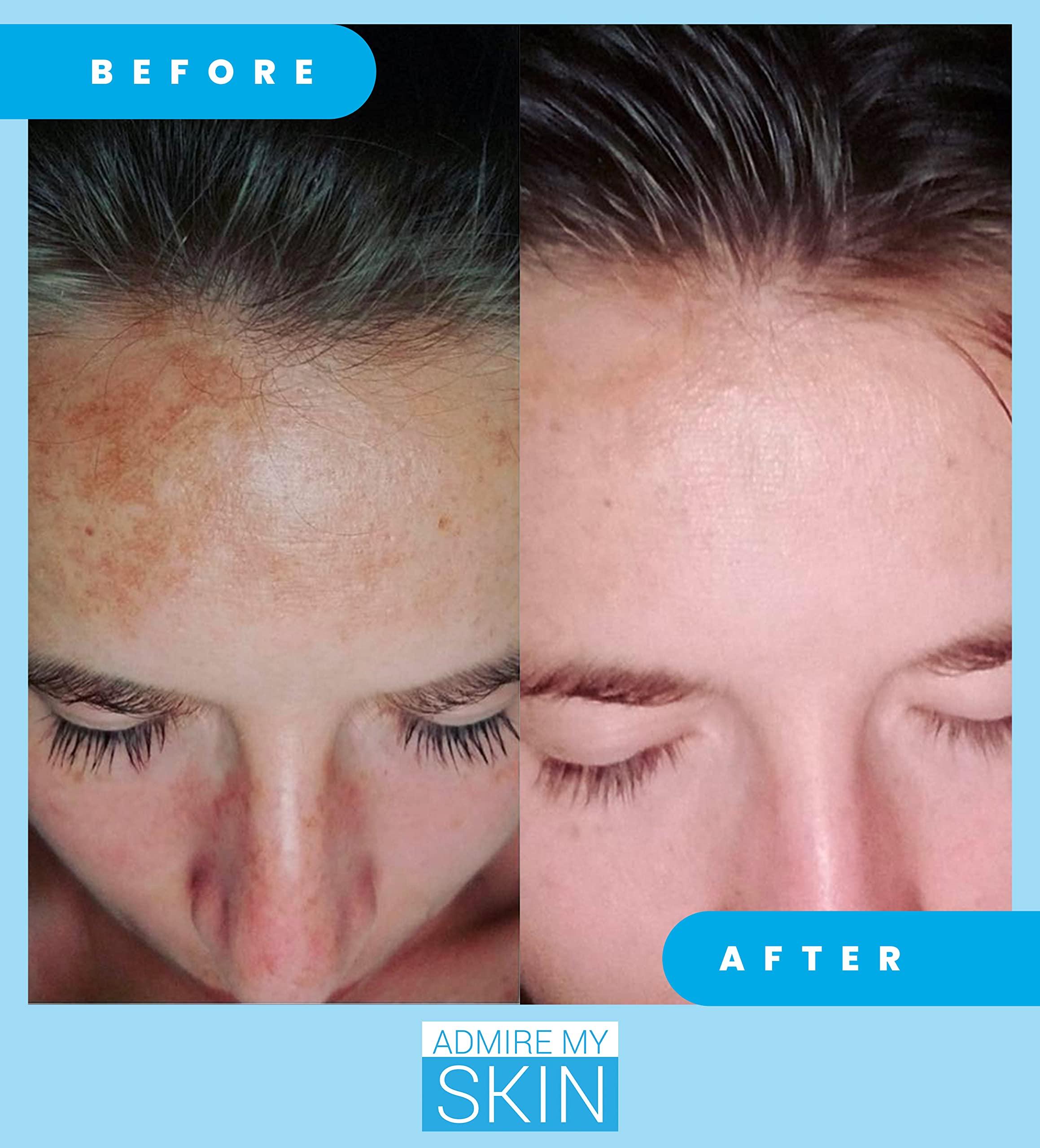 Admire My Skin Admire My Skin Dark Spot Corrector Serum + Retinoid Cream Set