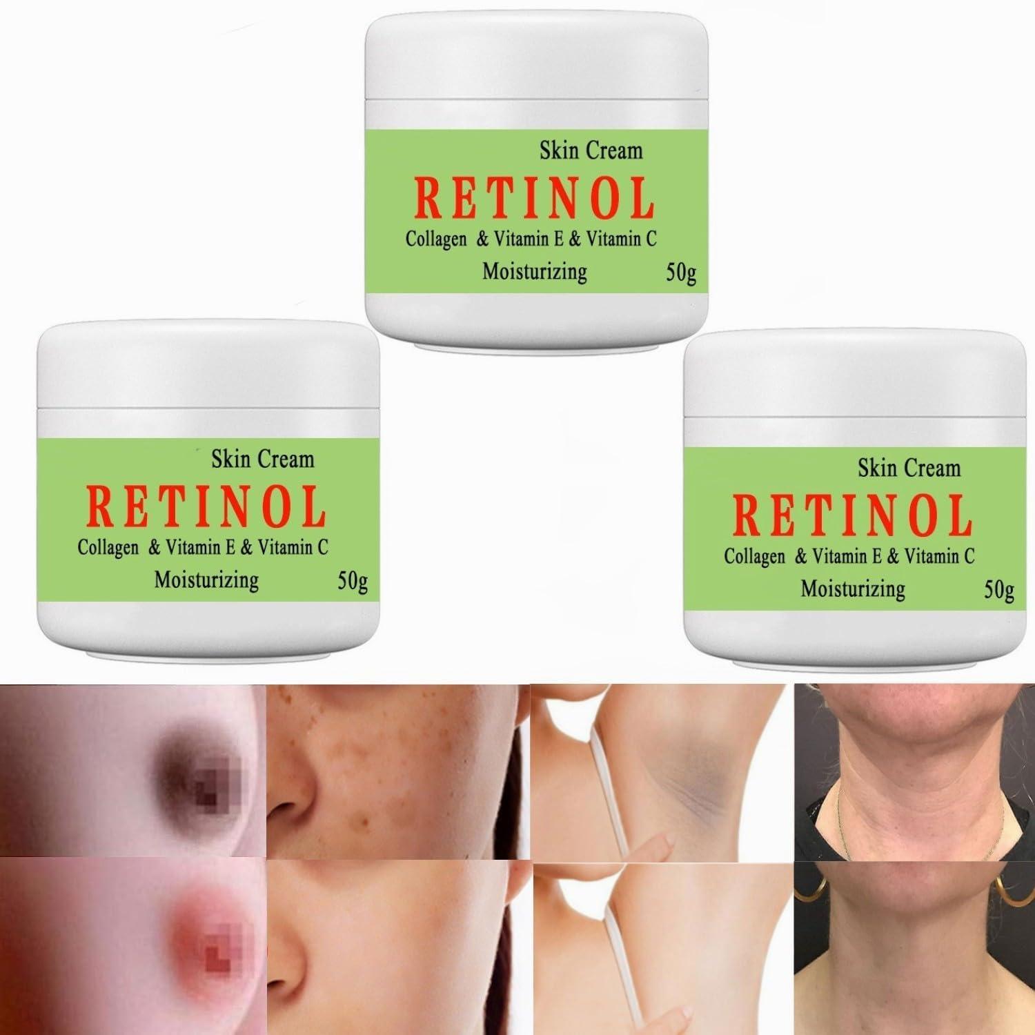 BEROZA BEROZA Cremas Para Las Manchas de La Cara, 50g Vitamin C&E Face Moisturizer Cream, Adecuado para varias reas como cara, axilas, cuello, zona privade (3pcs)