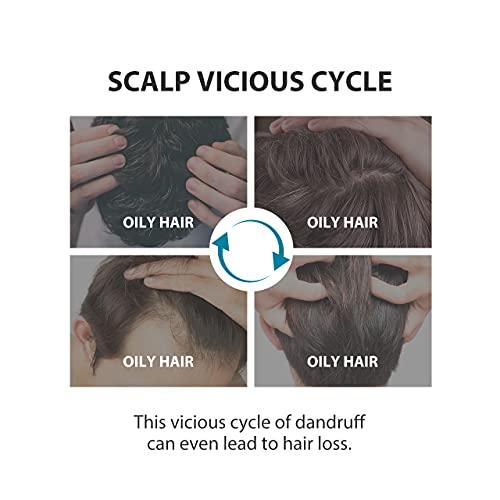 DASHU DASHU Daily Scalp Deep Cleansing Shampoo 16.9fl oz – Anti-dadruff, Prevent hair loss, Cooling effect, pH balanced, Scalp care, Relief of itchy