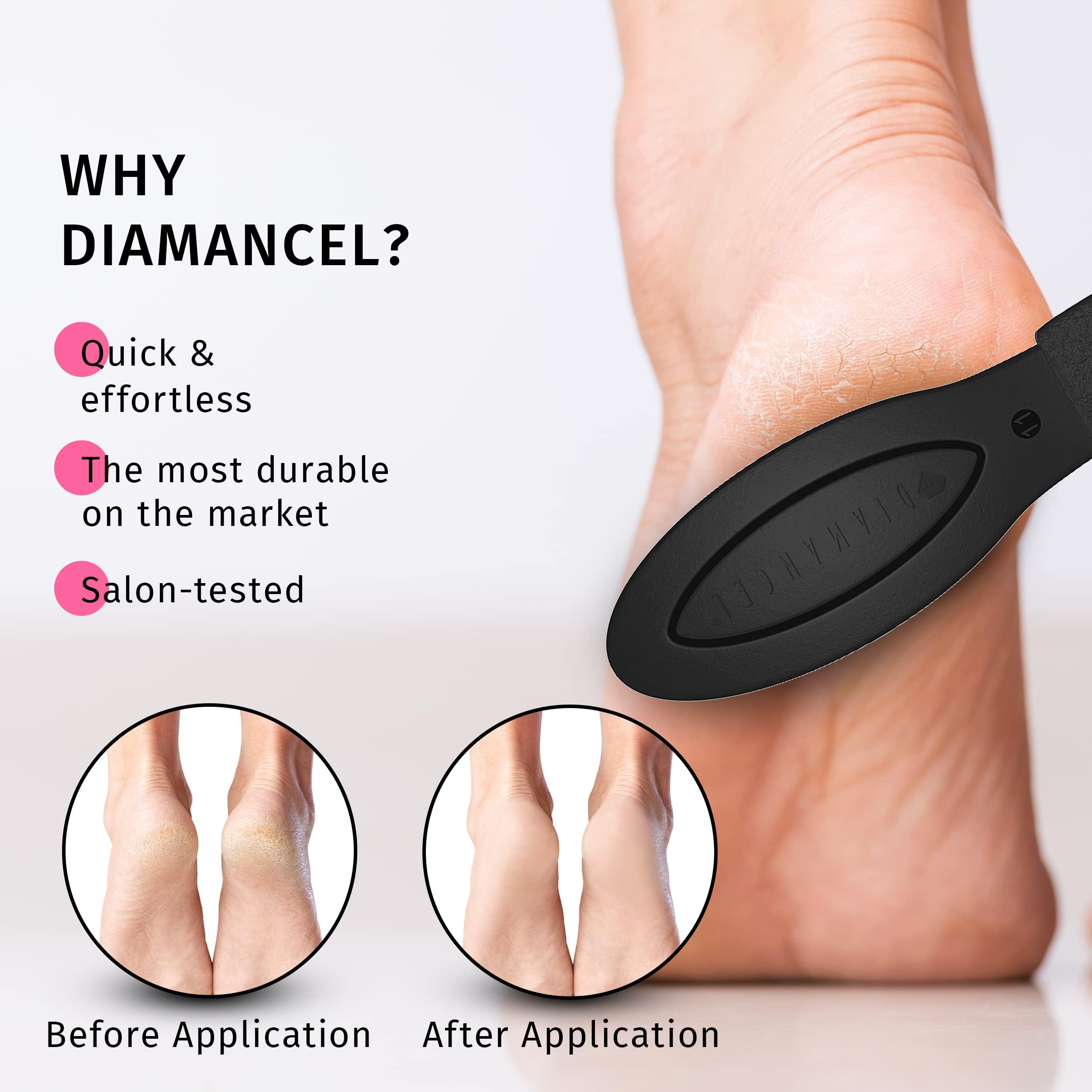 Diamancel Diamancel Luxury Diamond Foot Buffer - #11 Medium Grit Rasp – For Average Calluses, Rough Skin & Regular Maintenance
