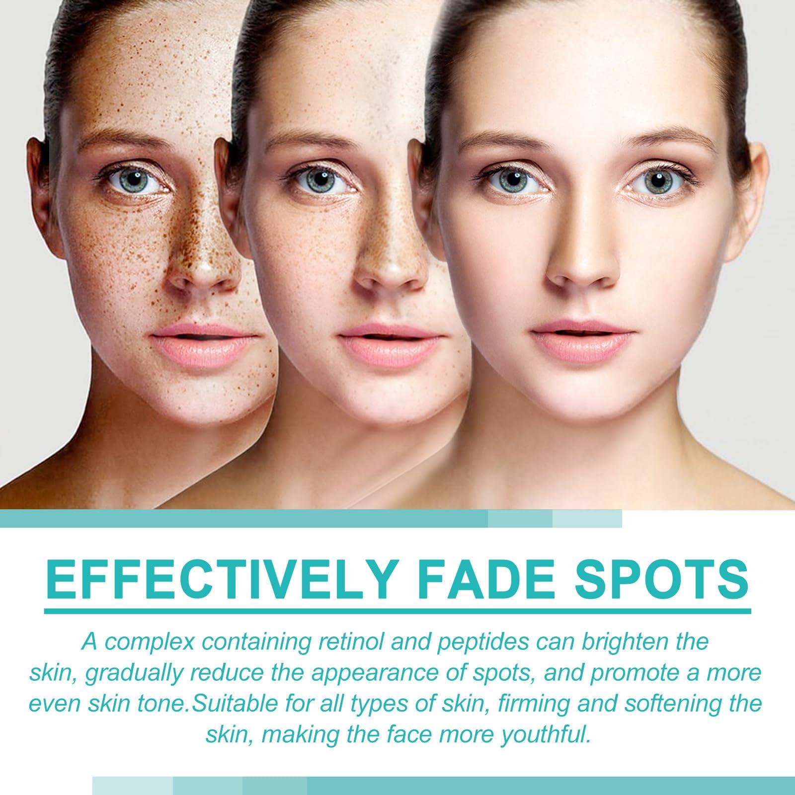 generic Dark Spot Remover for Face And Body, Dark Spot Remover (1)