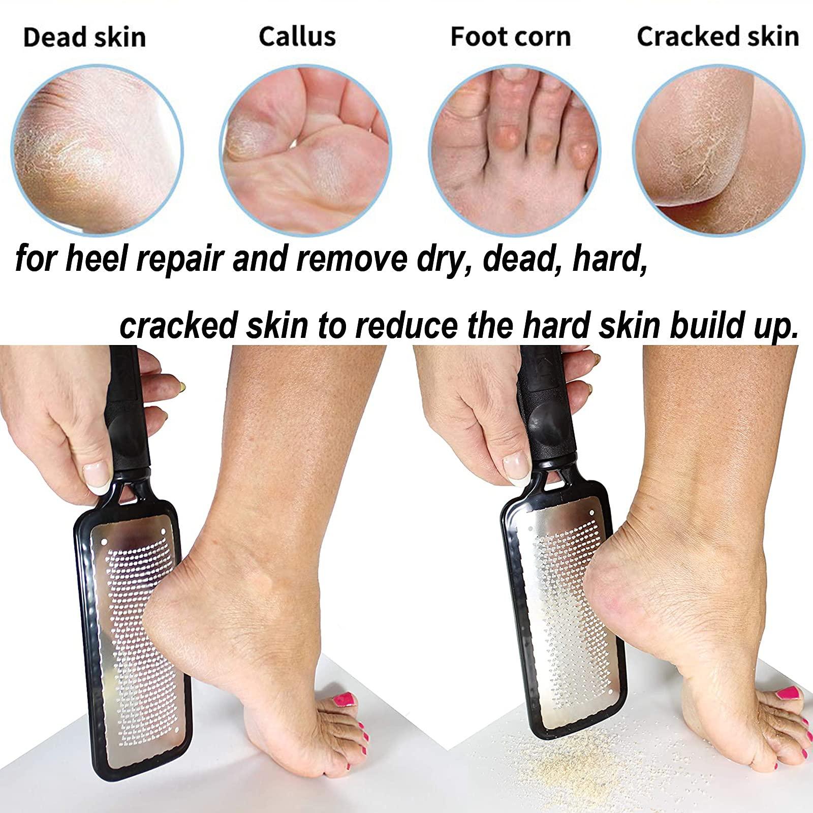 Angel Kiss Angel Kiss Colossal Foot File Scraper Pedicure File - Premium Stainless Steel Foot Rasp, Dead Skin Callus Remover for Feet, Gentle Foot Scrubber, Pedicure Tools for Salon-Quality Foot Care, Black