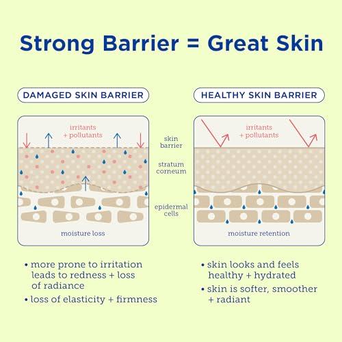 Skinfix Skinfix Resurface+ AHA/BHA Renewing Cream: Exfoliating Body Cream That Visibly Smooths Rough, Bumpy & Crepey Skin While Moisturizing With Shea Butter, Jojoba Oil & Glycerin, 10 Fl Oz