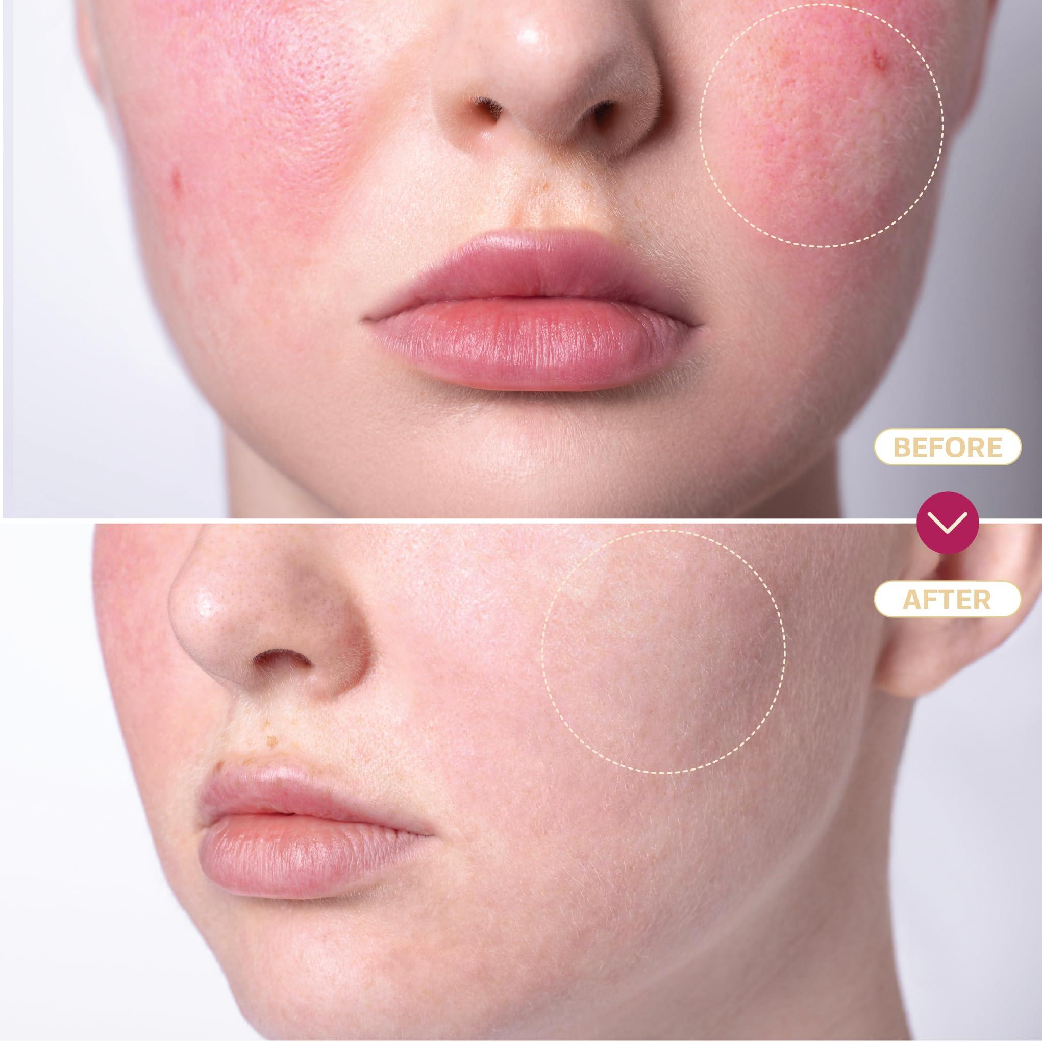 BASE LABORATORIES BASE LABORATORIES Hypochlorous Acid Spray for Face & Skin | 8 oz | Magic Facial Spray Daily Skin Repair Solution for Sensitive Skin, Redness, Irritations, Eczema, Acne. Hypochlrous HOCL Molecule Spray