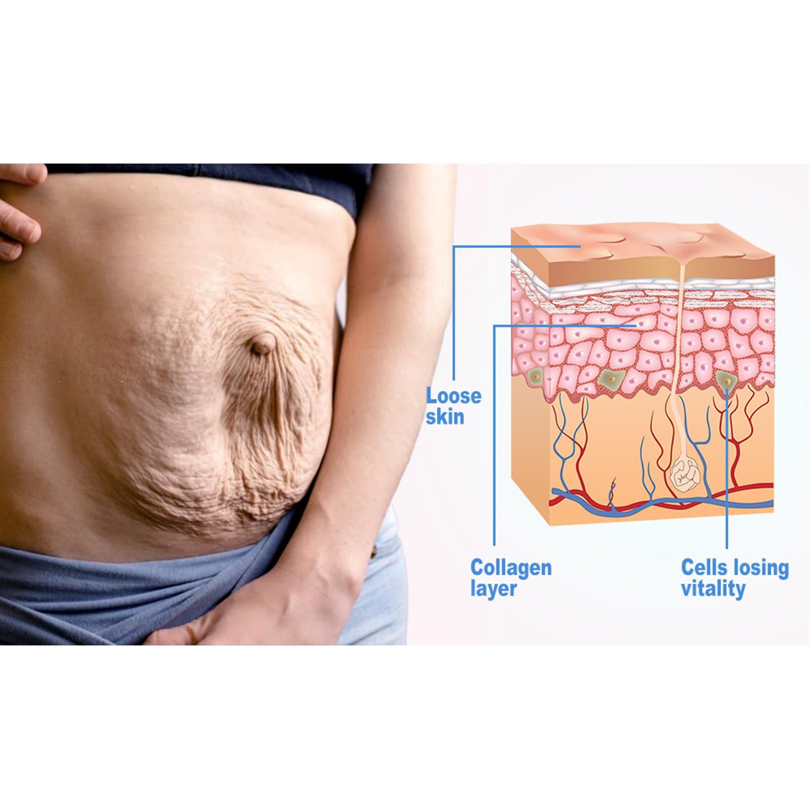 AEEHFENG Aeehfeng Firm Tighten Skin Tighten Cream,Anti-Aging Neck and Dcollet Day&Night Body Cream,Collagen Cream Face Lotion & Body Lotion,Moisturizing,Lifting&Recovery for All Skin Type (3Bottles, 3.47 oz)