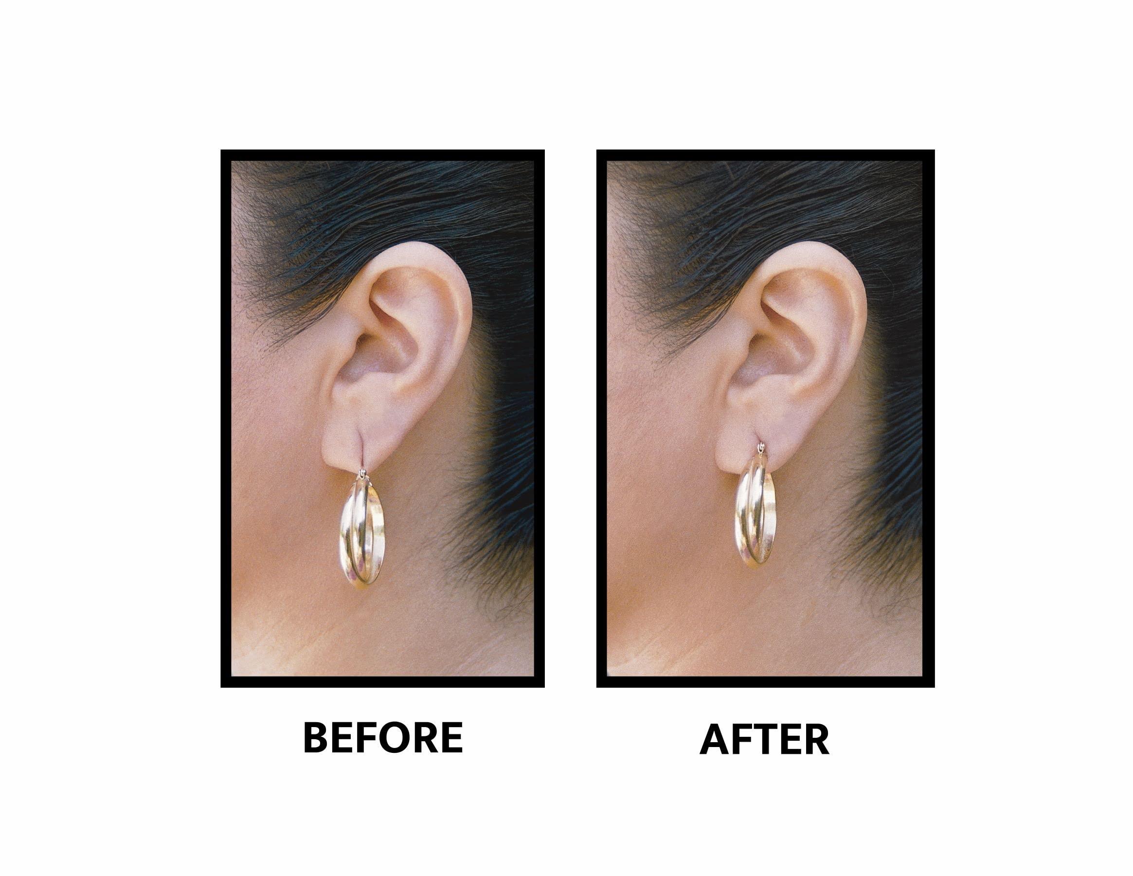 Lobe Wonder Lobe Wonder - The ORIGINAL Ear Lobe Support Patch for Pierced Ears - Eliminates the Look of Torn or Stretched Piercings - Protects Healthy Ear Lobes from Tearing - 420 Patches - Clear & Latex-Free