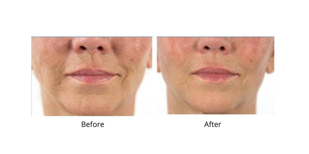 Dr.Sevinor Skincare Solutions Dr Sevinor Wrinkle Solution Smoothing Tinted Serum and Dr. Sevinor\'s Facelift Solution Concentrated Serum Revitalizes Tired Looking Skin, Diminishes Wrinkles/Lines. Combo Special SAVE 10%