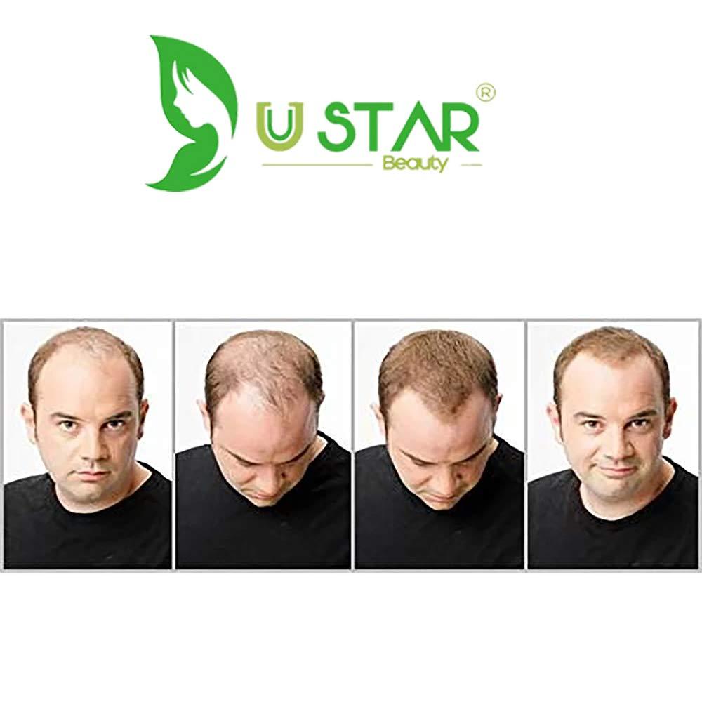 Ustar Ustar Hair Building Fibers for Thinning Hair 27.5g Light Brown Conceals Hair Loss Instantly Thicker Fuller Look 9 Shades for Women & Men