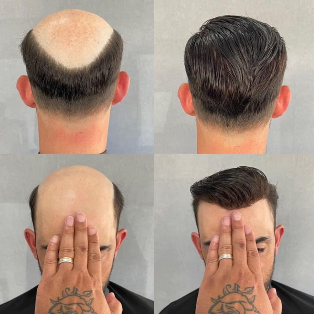 Eversilky Eversilky Super Ultra Thin Skin 0.02mm Full Skin Human Hair Men\'s Toupee Undetected Natural Hairline Prosthesis Capillary V Loop System (#2, dark brown, 0.03mm pu)