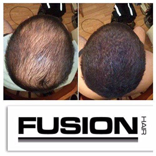 Hair Fusion Hair Fibers for Thinning Hair - (1.05 Oz) Real Human Hair Building Fibers to Conceal Bald Spots and Thinning Hair, Root Touch Up and Volumizer, Brown
