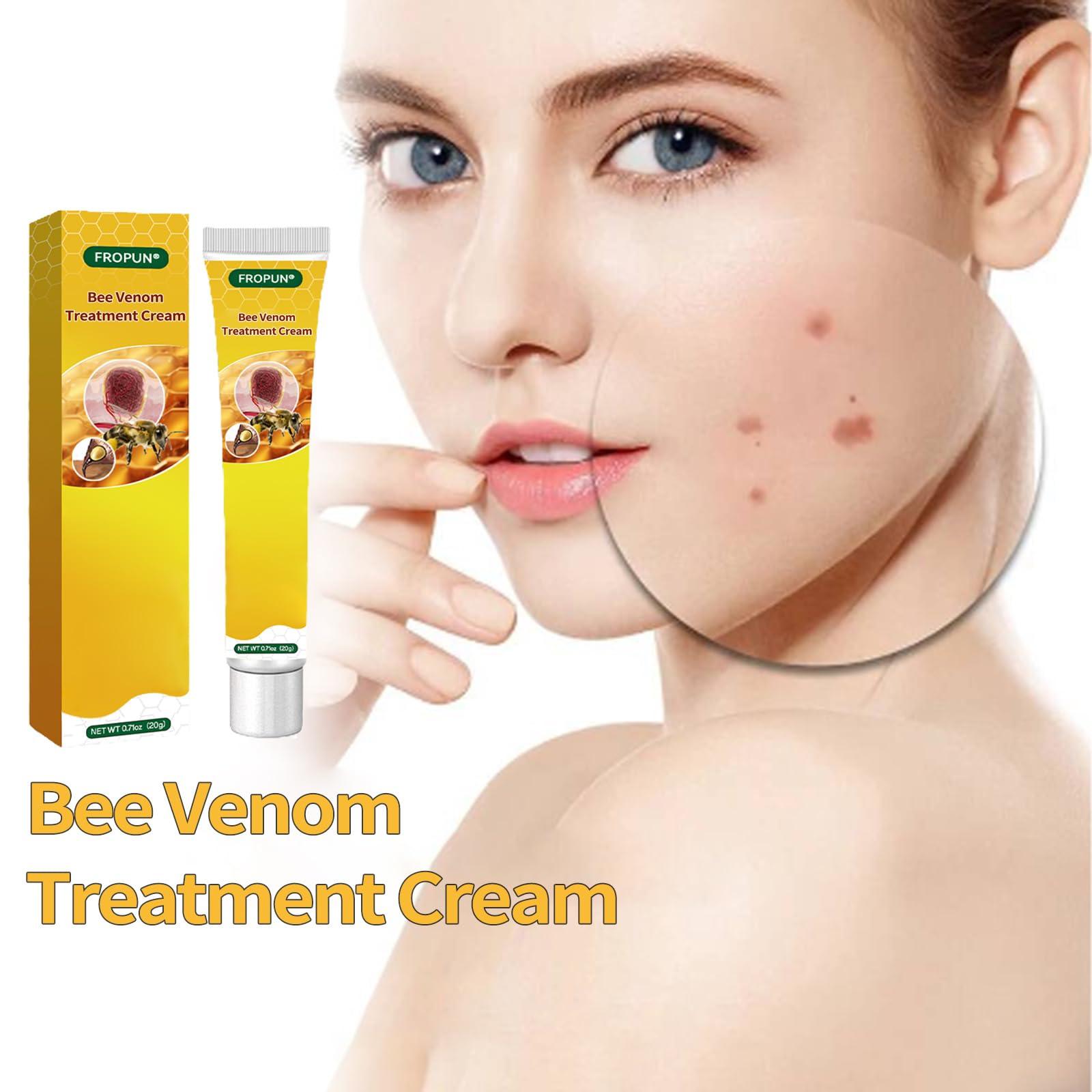 TLOPA TLOPA Bee Venom Treatment Cream, New Bee Venom Repair and Removing Cream,Hydrating Moisturizing Treatment cream for Men&Women,1Fl Oz (4)