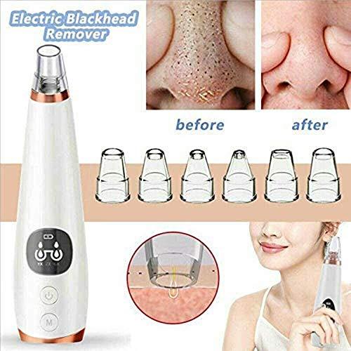 yigeren Qin Black Head Suctioner,Blackhead Remover Vacuum,Blackhead Remover Pore Vacuum - Electric Pore Cleaner, Blackhead Extractor Tool for Women and Men,USB Rechargeable LCD Display