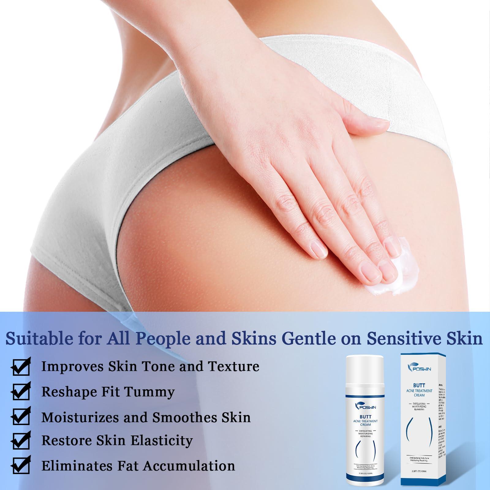 POSWIN POSWIN Butt Acne Clearing Treatment Cream: Acne Clearing Lotion for Butt and Back - Moisturize Cream with Salicylic Acid & Tea Tree Skin Delicate Smooth Body Care for Men Women - 100ML