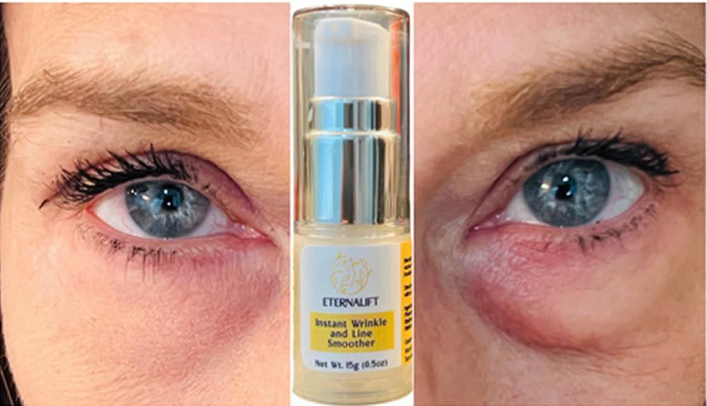 Generic Instant Eye Bag Puffiness And Wrinkle Remover Cream For Women And Men Made In The USA! Cruelty-Free