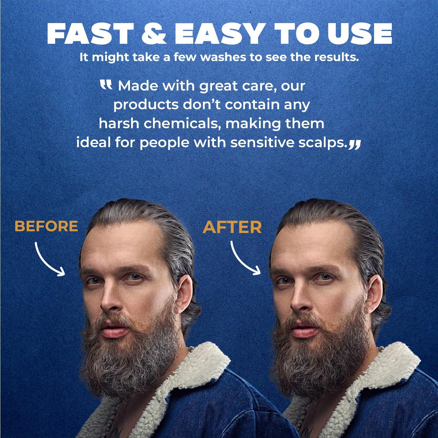 MENFIRST MENFIRST - Gradual Gray Hair Reducing Shampoo - Reverse and Darken Light Brown to Blonde Hair - Hypoallergenic & Harsh Chemical-Free for Men - 1 Pack - 5 Oz