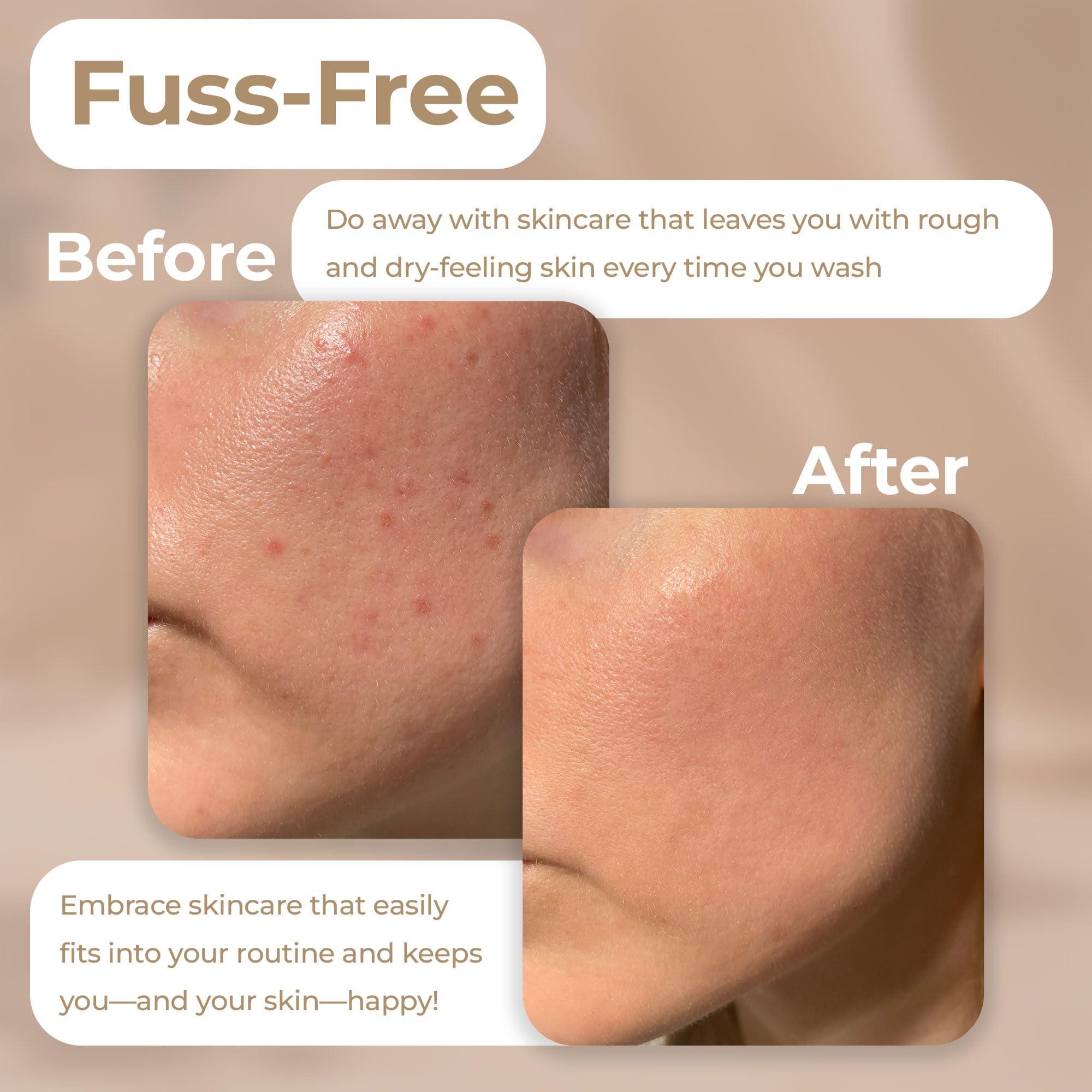 Vivo Per Lei Vivo Per Lei Facial Peeling Gel - Contains Dead Sea Minerals and Nut Shell Powder - Gentle Face Exfoliator Scrub and Blackhead Remover - Pack of 3