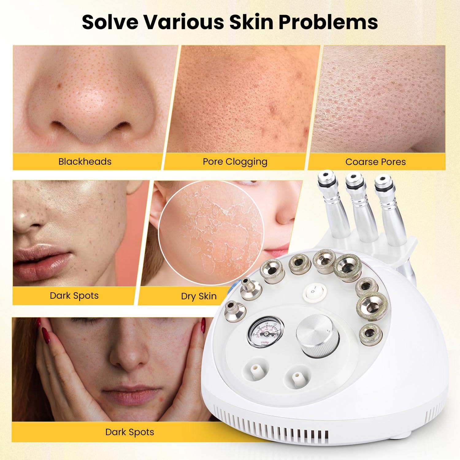 UNOISETION UNOISETION Microdermabrasion Machine and Diamond Tips Kit