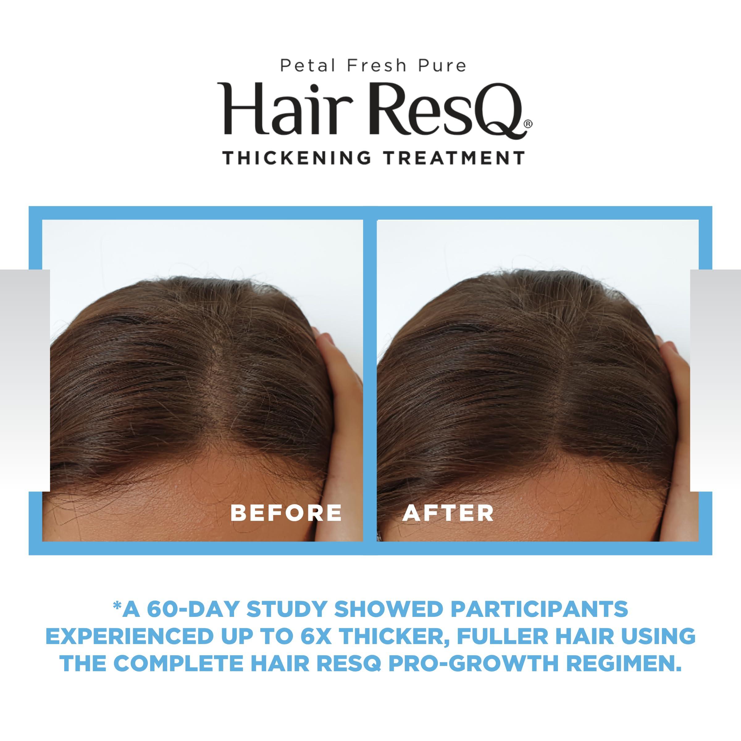 Petal Fresh Petal Fresh Hair ResQ Original Formula Natural Thickening Biotin Shampoo & Weightless Conditioner For Noticeably Thinning Hair, Strengthens & Volumizes, Vegan & Cruelty-Free 2 Count (Bundle)