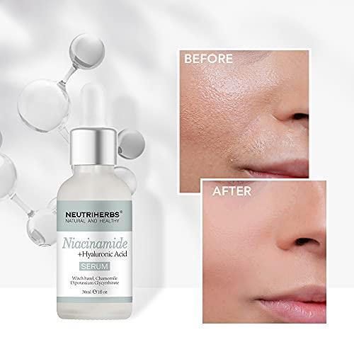 Neutriherbs Neutriherbs 4% Niacinamide Serum for Face the Ordinary + HA,Effectively Work to Control Excess Facial Oil, Minimize the Pores and Prevent Breakouts, Best Niacinamide Serum For Oily Skin