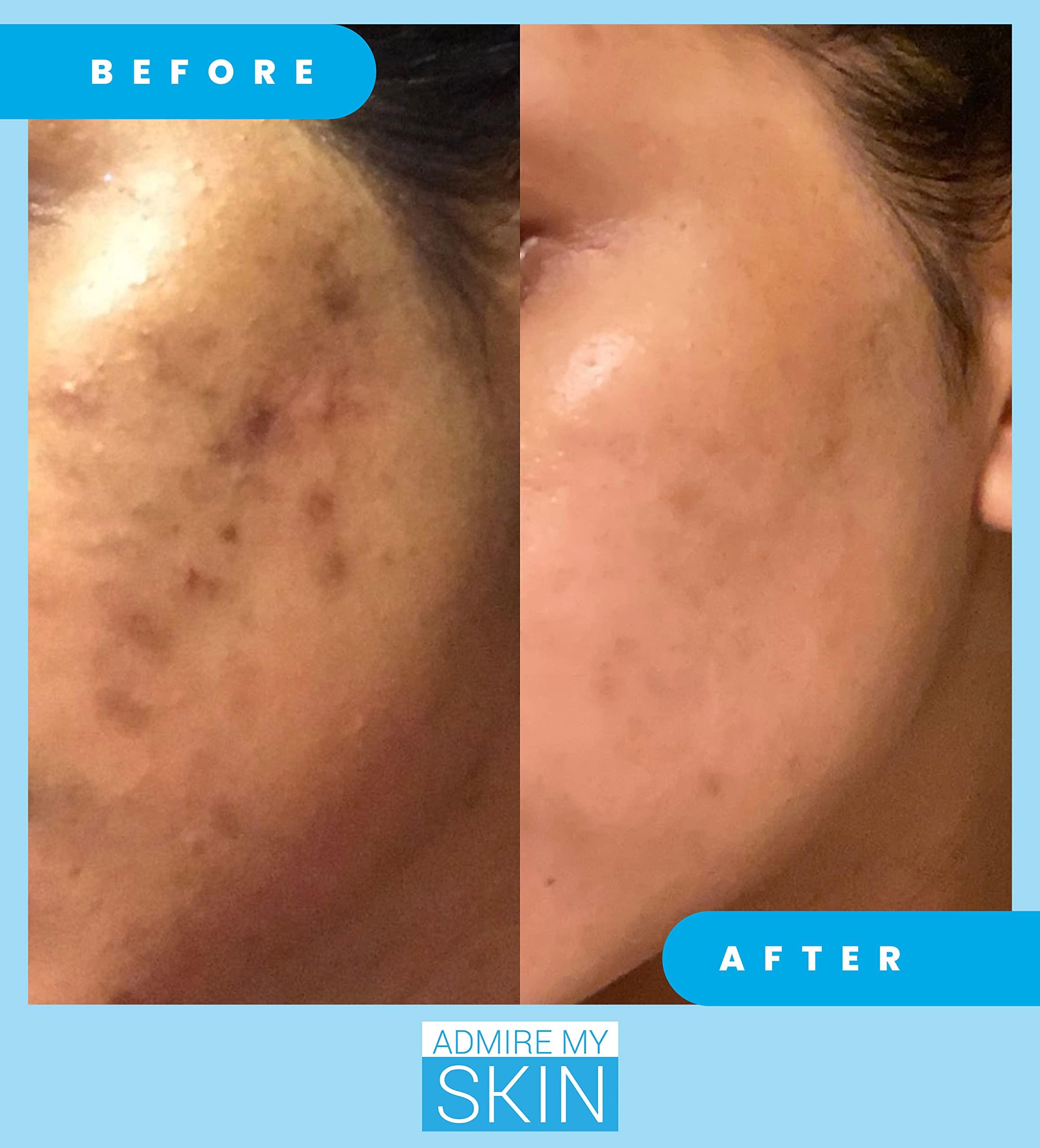 Admire My Skin Admire My Skin Dark Spot Corrector Serum + Retinoid Cream Set