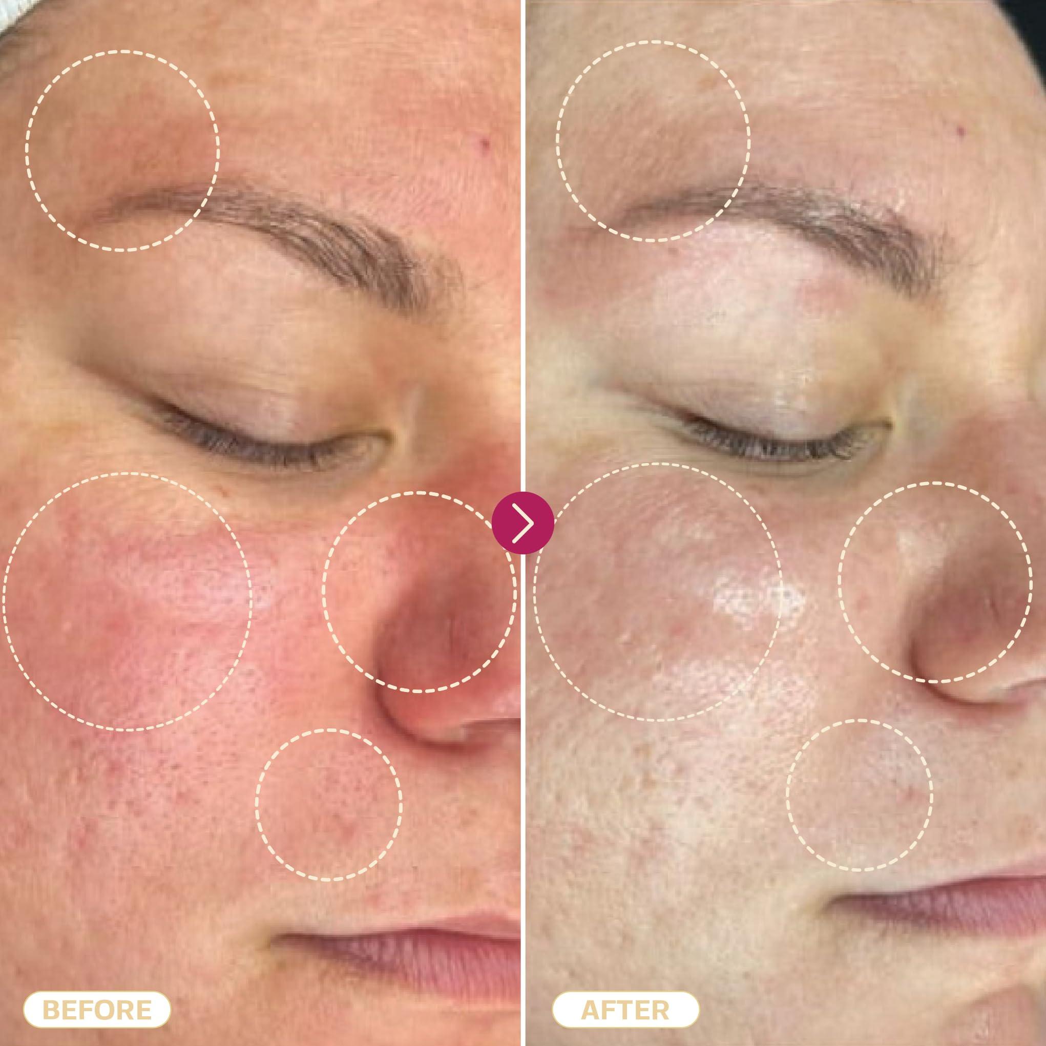 BASE LABORATORIES BASE LABORATORIES Hypochlorous Acid Spray for Face & Skin | 8 oz | Magic Facial Spray Daily Skin Repair Solution for Sensitive Skin, Redness, Irritations, Eczema, Acne. Hypochlrous HOCL Molecule Spray