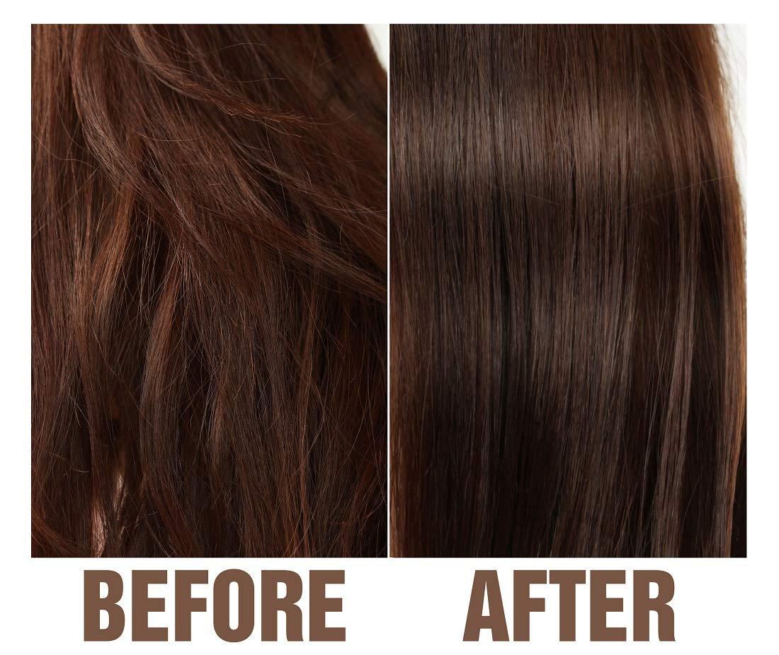 Olivia Care Olivia Care Tea-Tree & Aloe Hair Scalp Serum Natural & Vegan Ingredients - Moisturize &, Anti-Itch Hair & Scalp Treatment - Stimulate Growth & Repair Hair Damage - 4 FL OZ