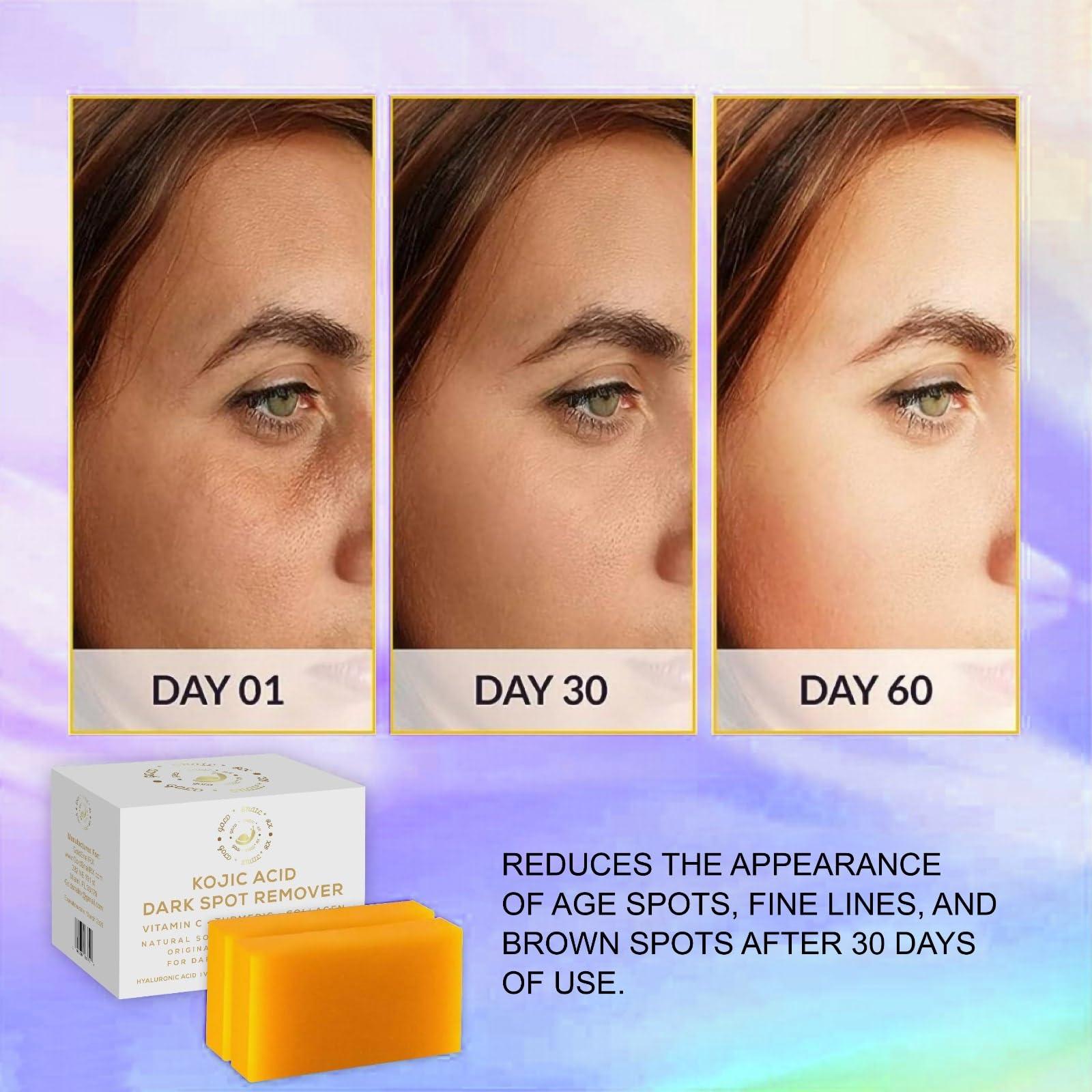 GoldSnailRX GoldSnailRX KOJIC ACID SOAP Original Dark Spot Remover (PACK OF 2 W/BAG) Authentic Kojic Acid Soap For Body Whitening-Kojic Acid Soap with Vitamin C,Tumeric, infused w/Hyaluronic Acid,Shea Butter