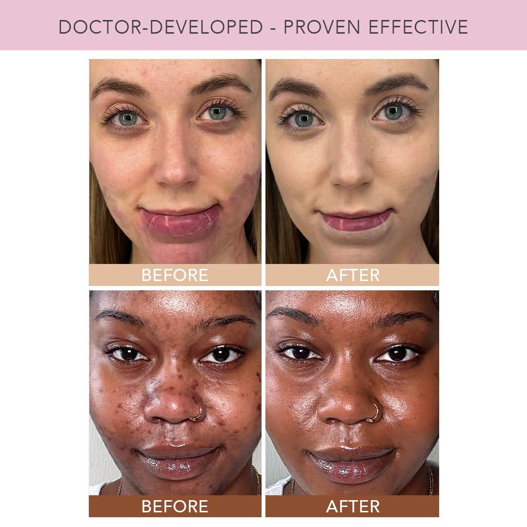 DOLL 10 NO. Doll 10 TCE Liquid Filter - Covers, Blurs, and Brightens (Deep)