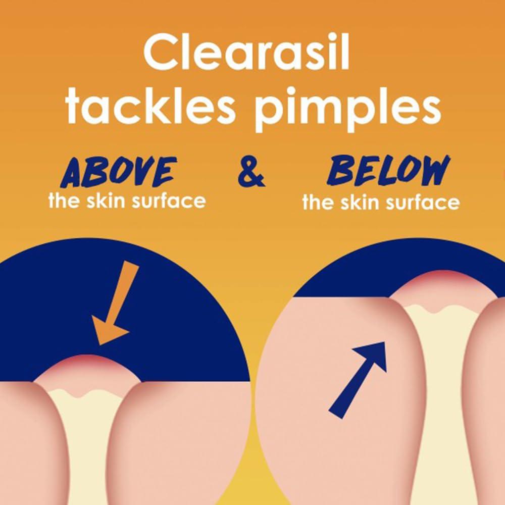 Clearasil Clearasil Ultra 5 in 1 Acne Face Wash Pads, 90 Count (Pack of 2)