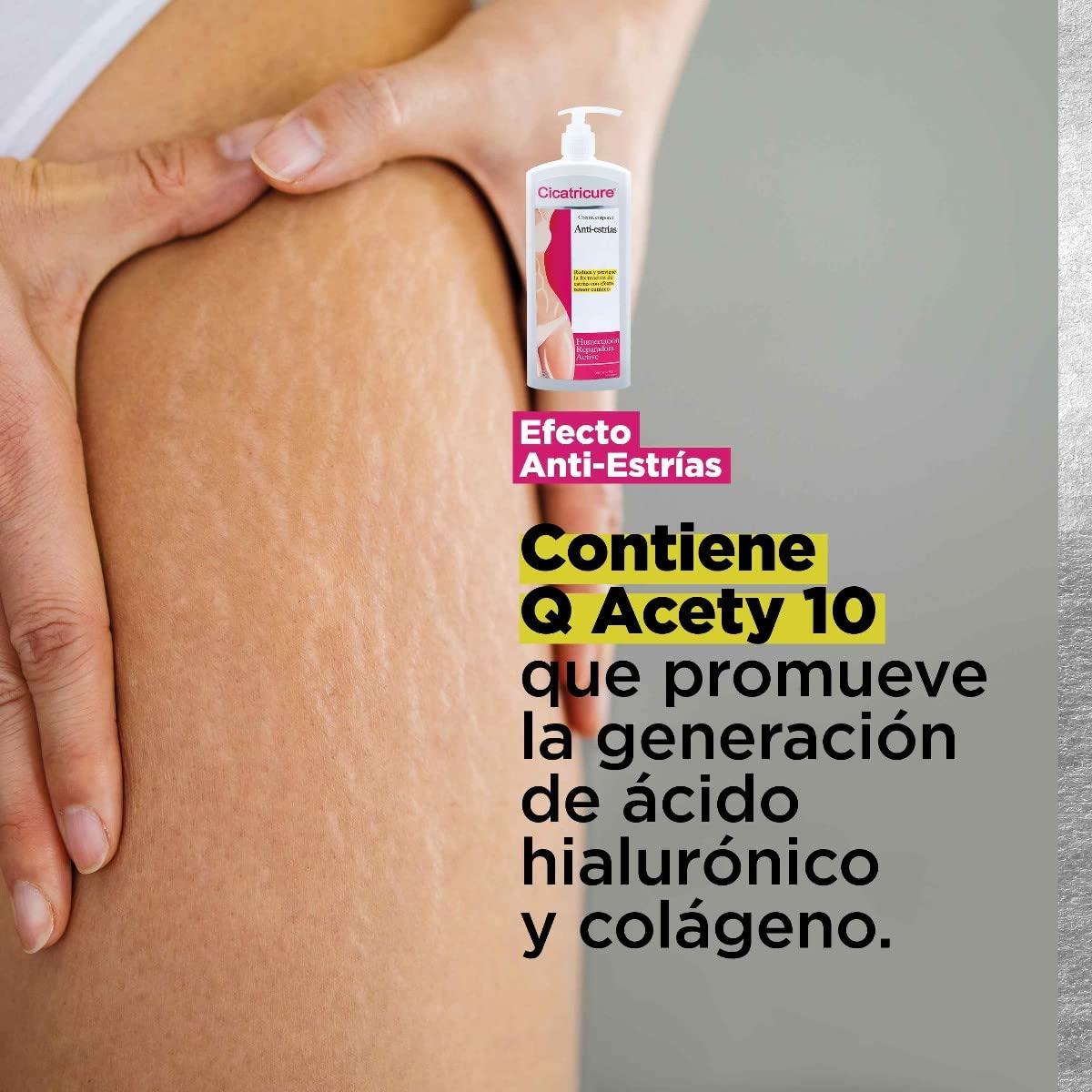 CICATRICURE Cicatricure Anti-Stretch Mark Cream, 13.6 Fl Oz, Whole Body Moisturizer for All Skin Tones