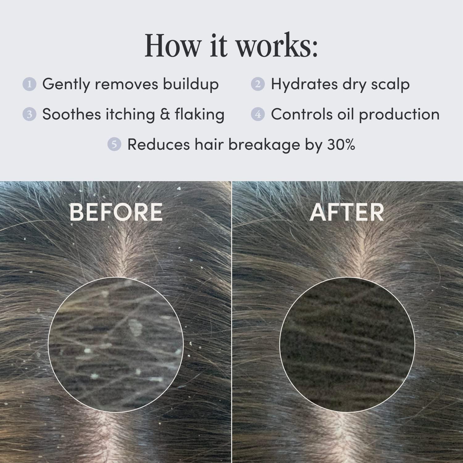 Jupiter Jupiter Balancing Shampoo, Nourishing Conditioner & Volcanic Ash Scalp Mask Trio - For Dry, Oily, Itchy, Flaky Scalp - Color Safe & Sulfate Free - Vegan