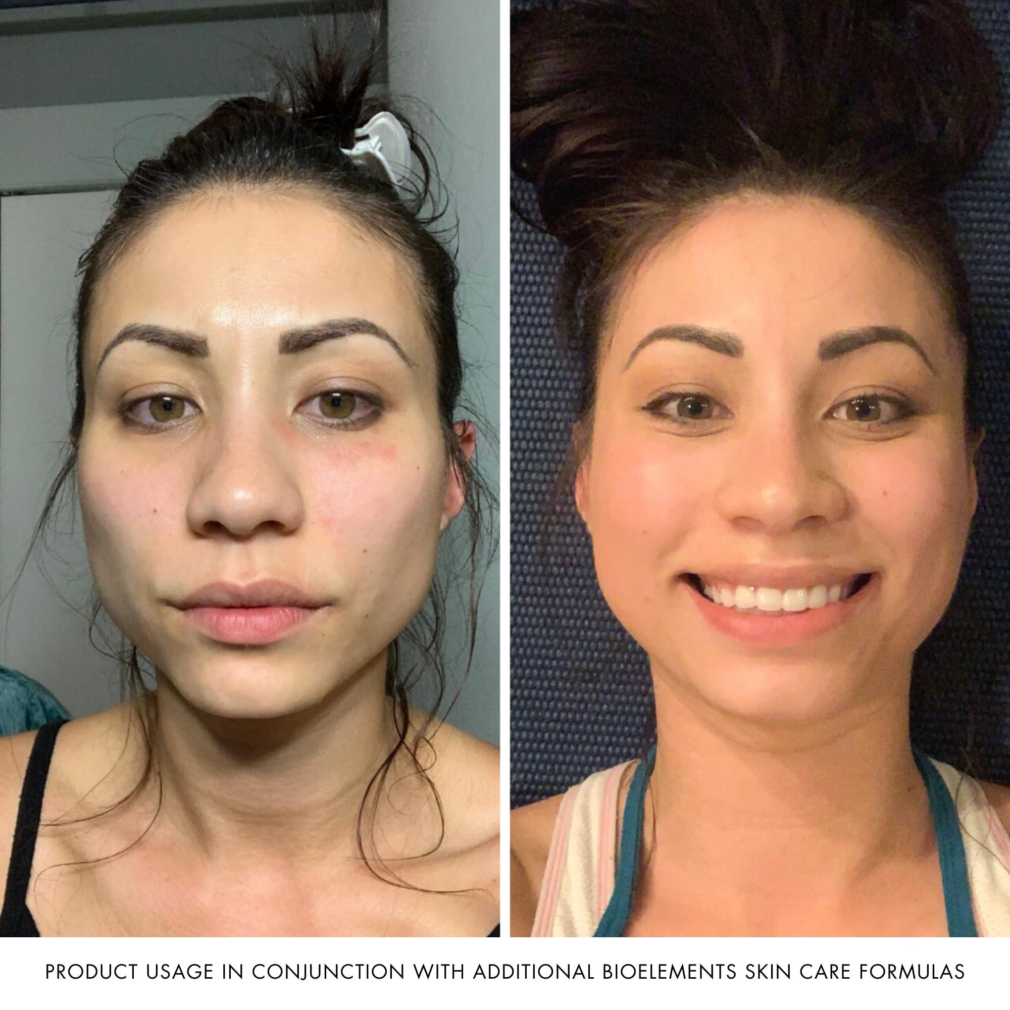 epicuren DISCOVERY epicuren DISCOVERY Acidophilus Probiotic Facial Cream, 4 Fl Oz