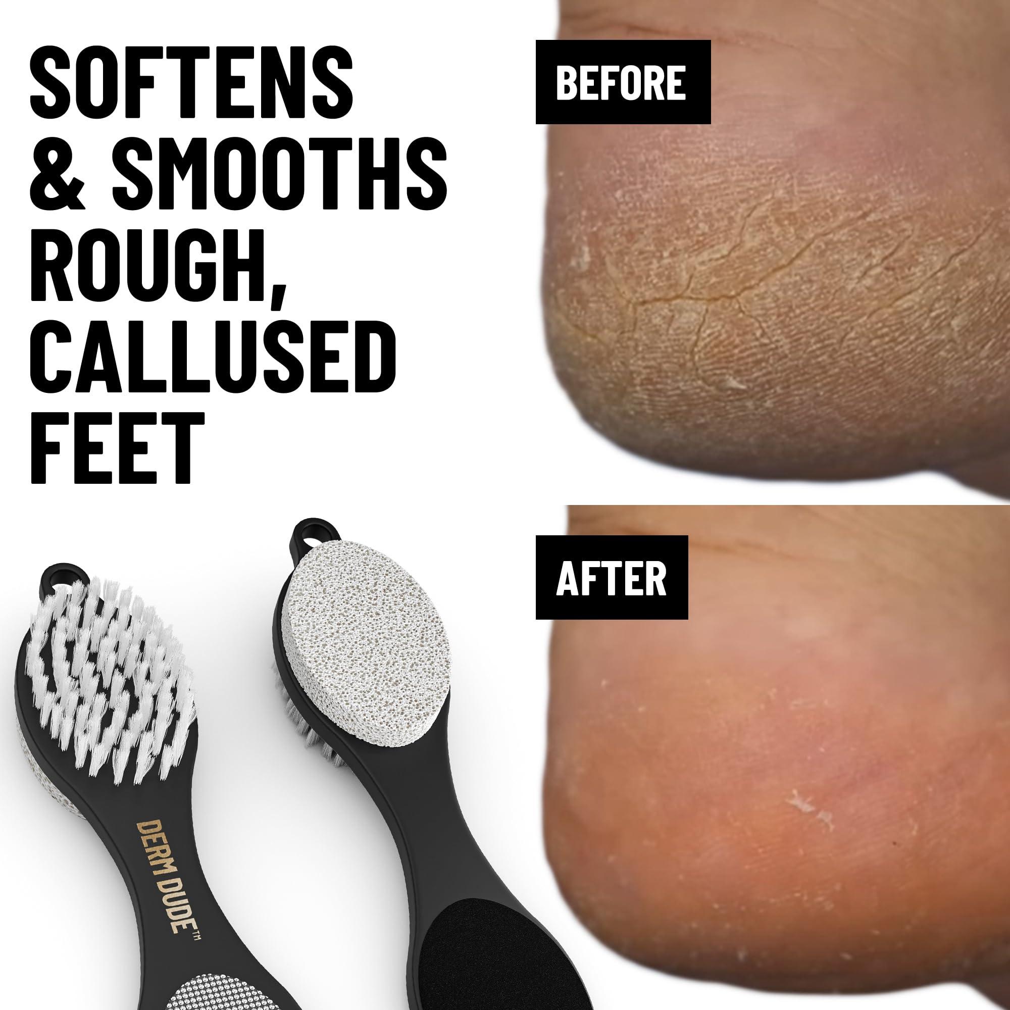 Derm Dude Derm Dude 4-in-1 Foot Scrubber & Heel Repair Tool | Foot File Callus Remover for Feet | Pedicure Tool with Metal File, Pumice Stone, Emery Board & Cleaning Brush to Soften & Smooth Rough, Dry Feet